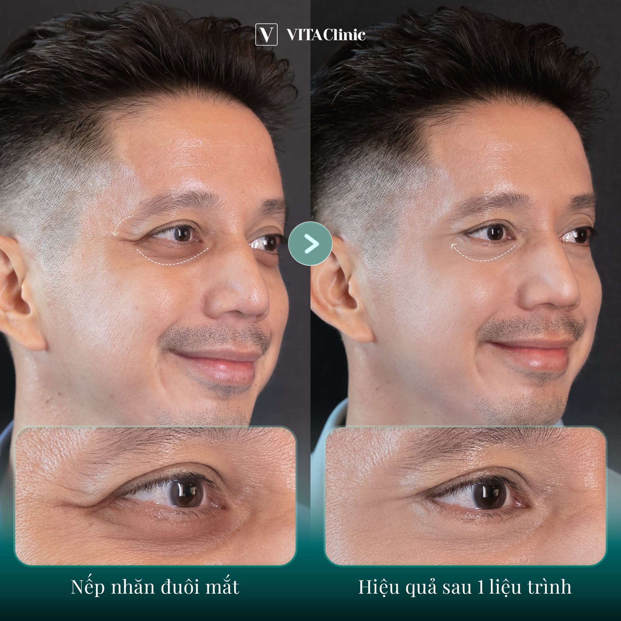 VITA Clinic Facebook ad