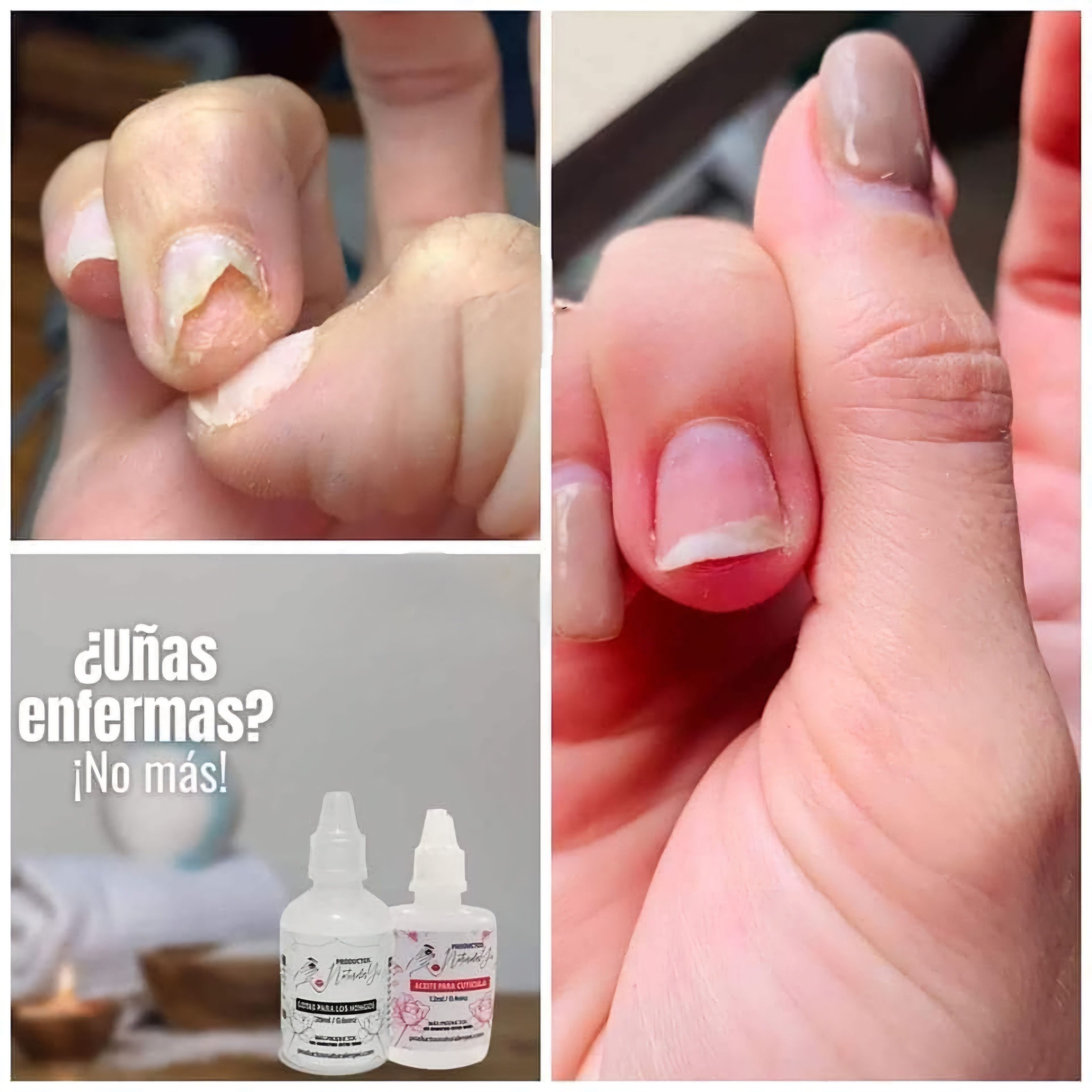 Productos Karii Facebook ad: Kit Antihongos