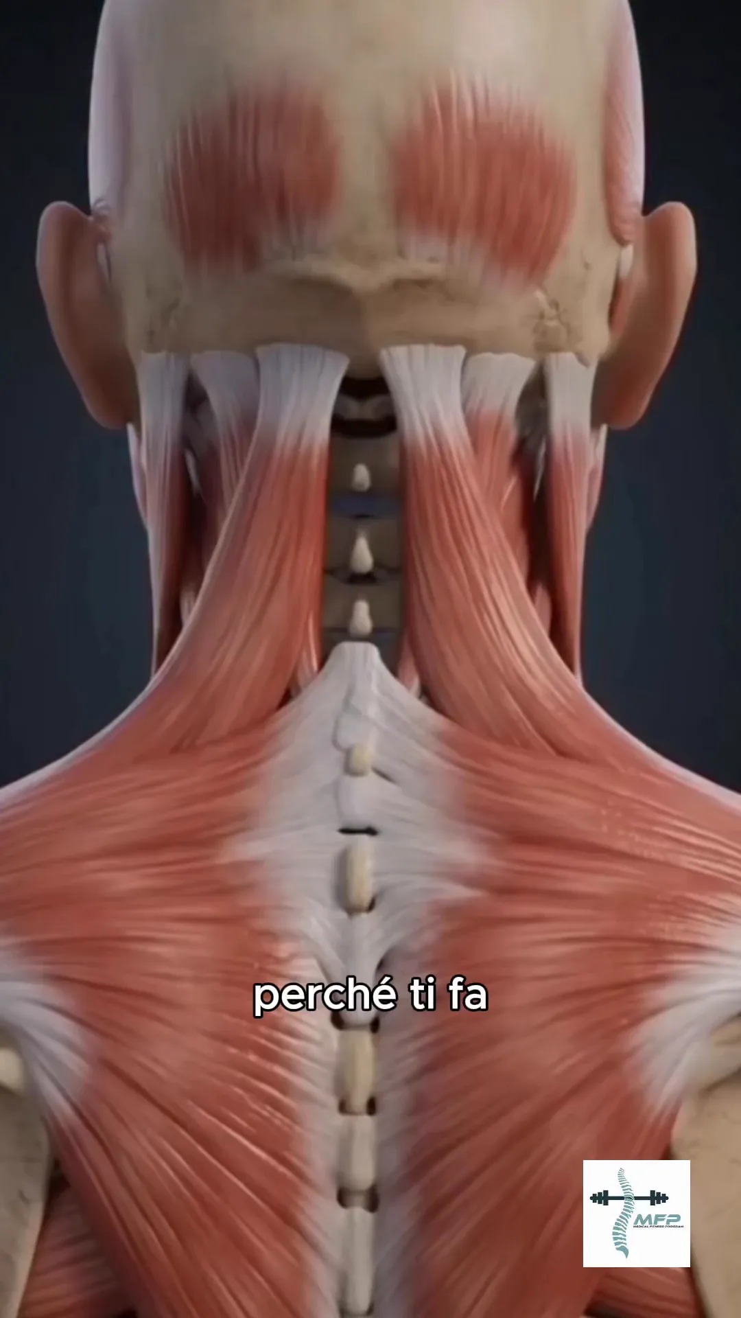 Medical Fitness Program ASD Facebook ad: Ti fa male la testa quando sei stressato?