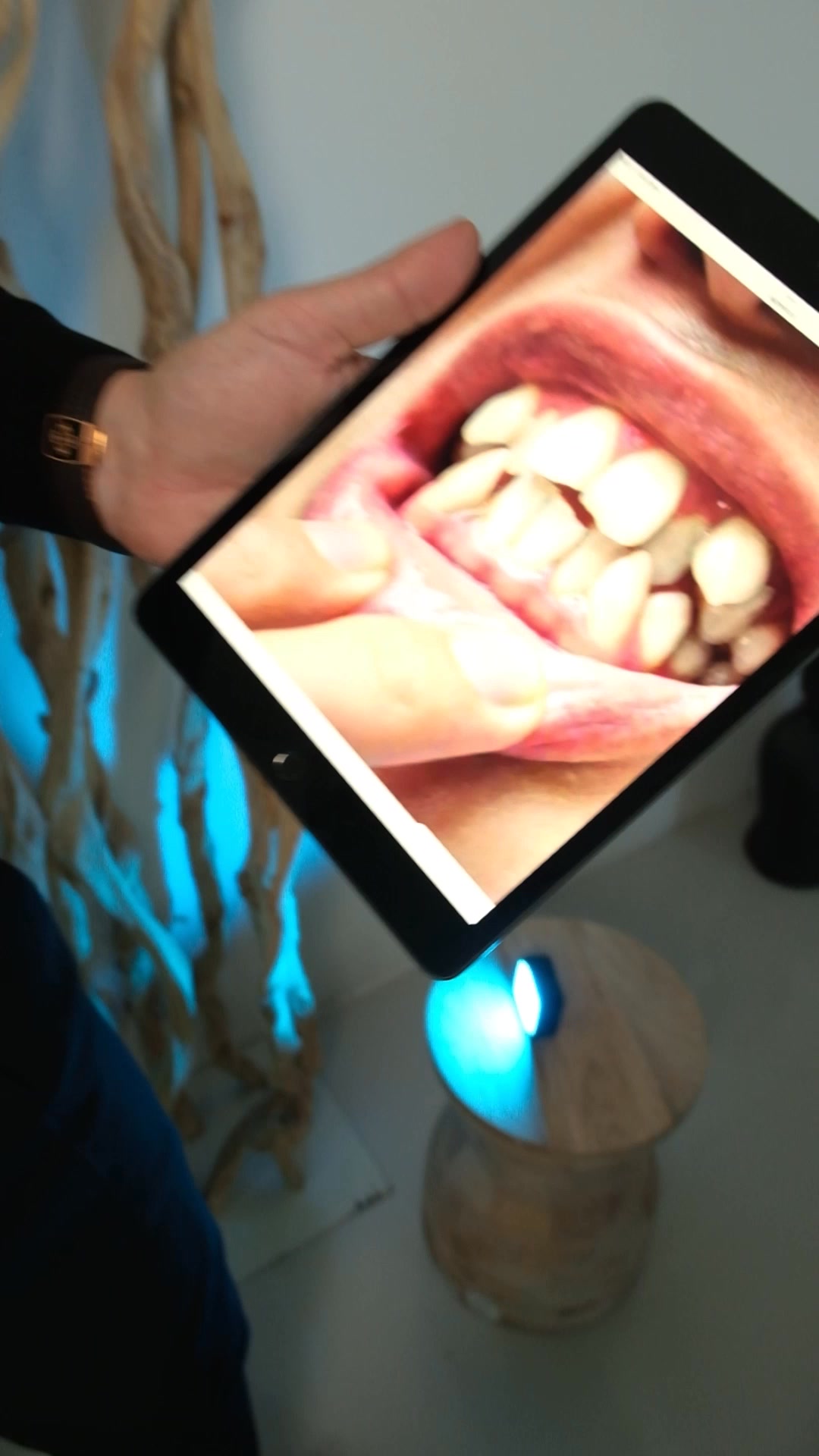 Studio Medico Dentistico Vassallo-Di Florio Facebook ad: Allinea i tuoi denti