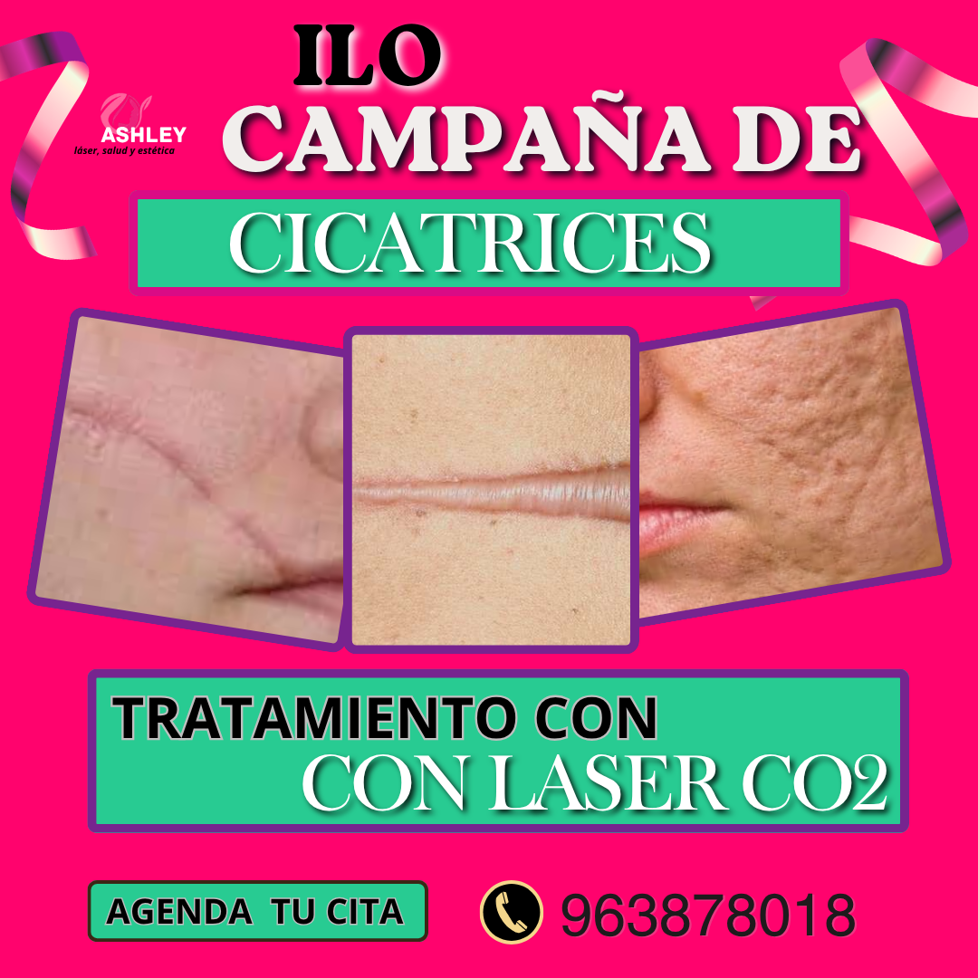 Laser Estétic Y Medicina Estética Integral Facebook ad: quiero una cita