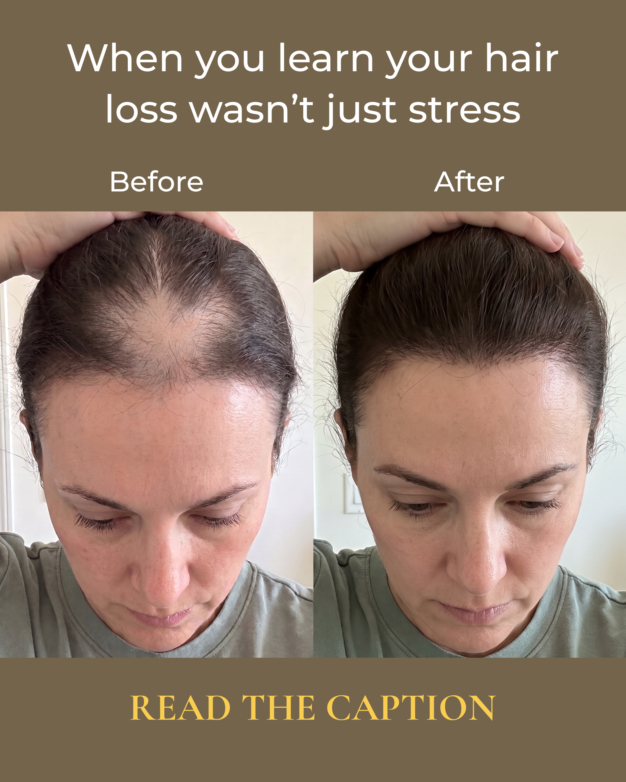 Dr. Patricia Sullivan Facebook ad: The Warning Sign Behind Your Hair Loss