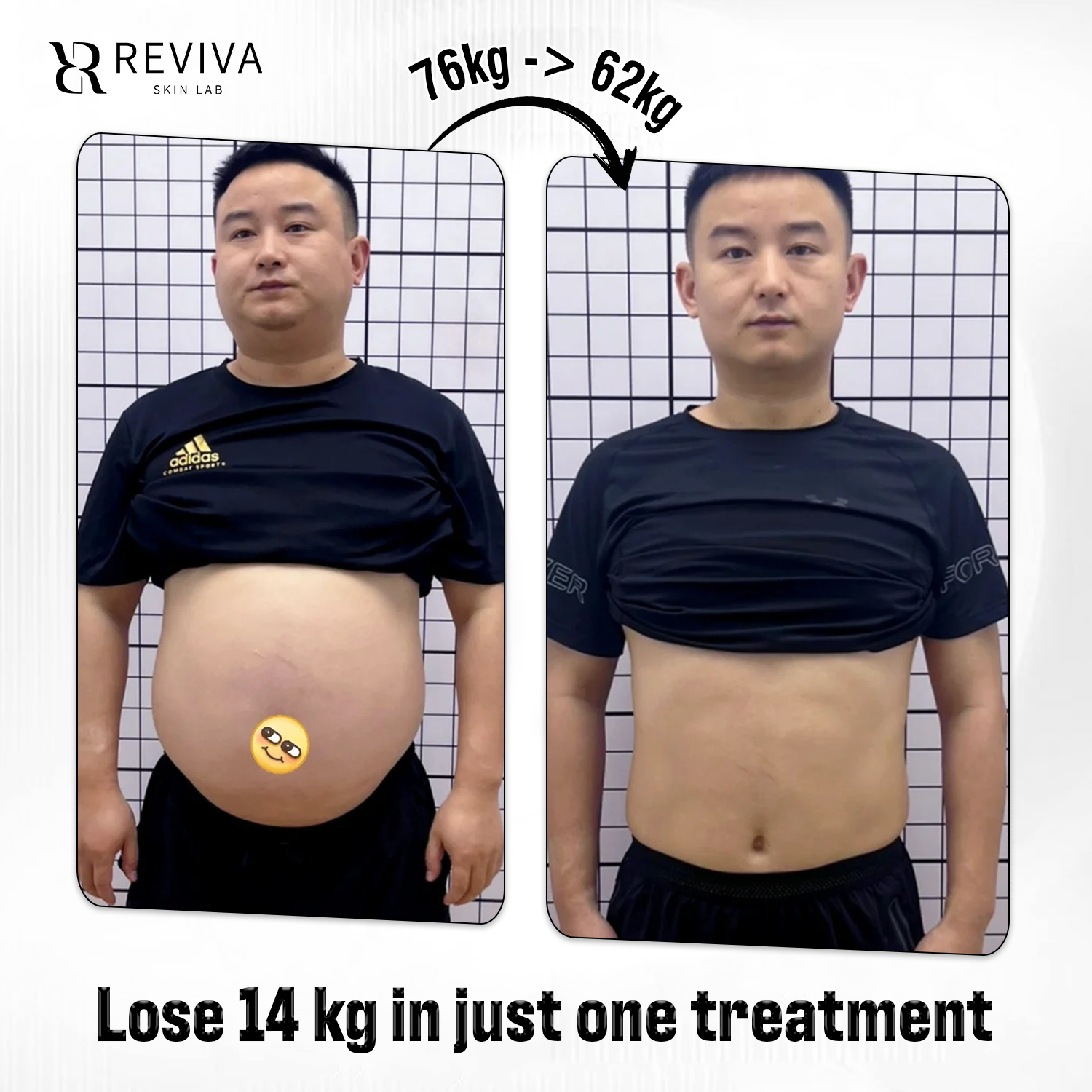Reviva Aesthetic & Beauty Clinic - Iloilo Branch Facebook ad from Aug 3, 2026