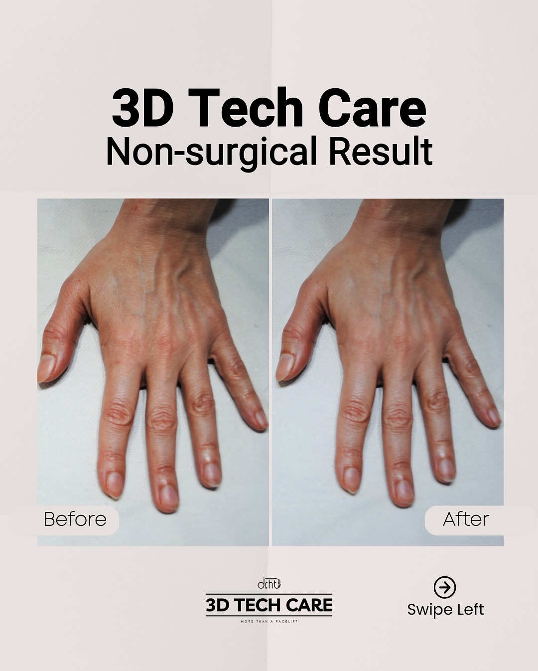 Dr. Hüseyin Tırman - Medical Aesthetic Facebook ad