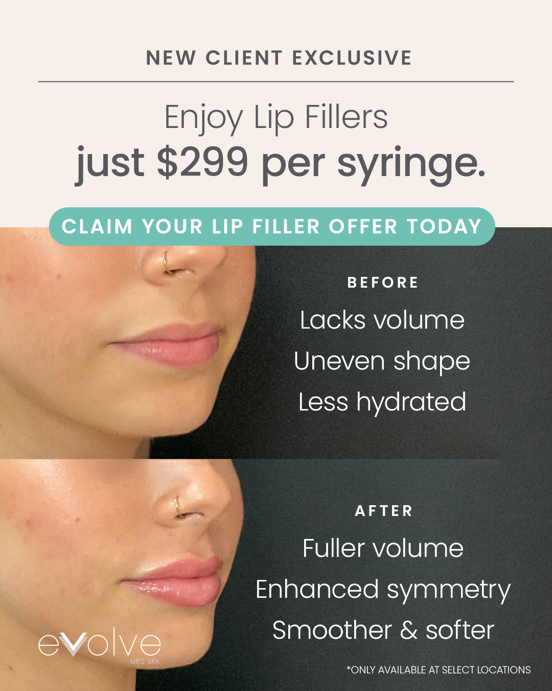 Evolve Med Spa Facebook ad