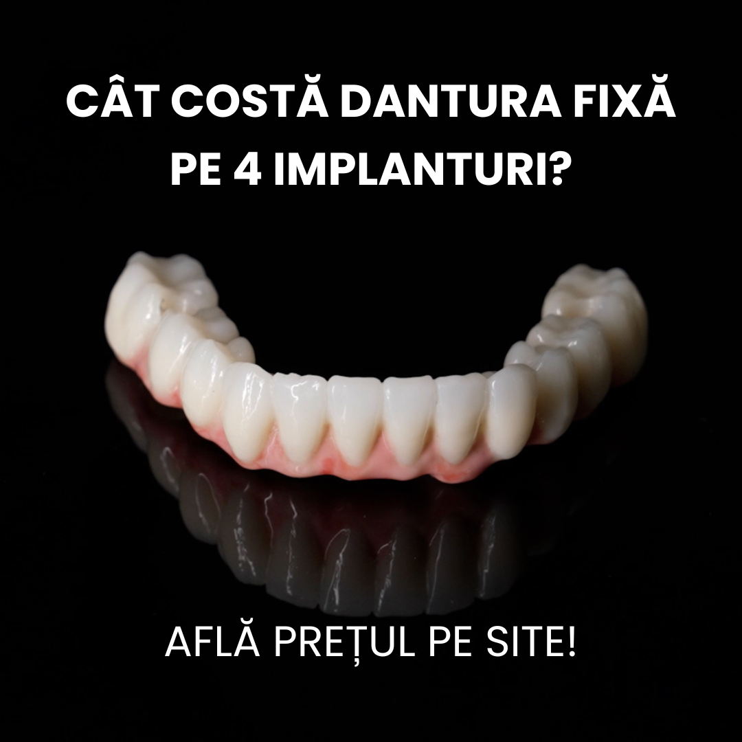 Centrul de Implantologie Dental Excellence Facebook ad: DANTURĂ FIXĂ PE IMPLANTURI