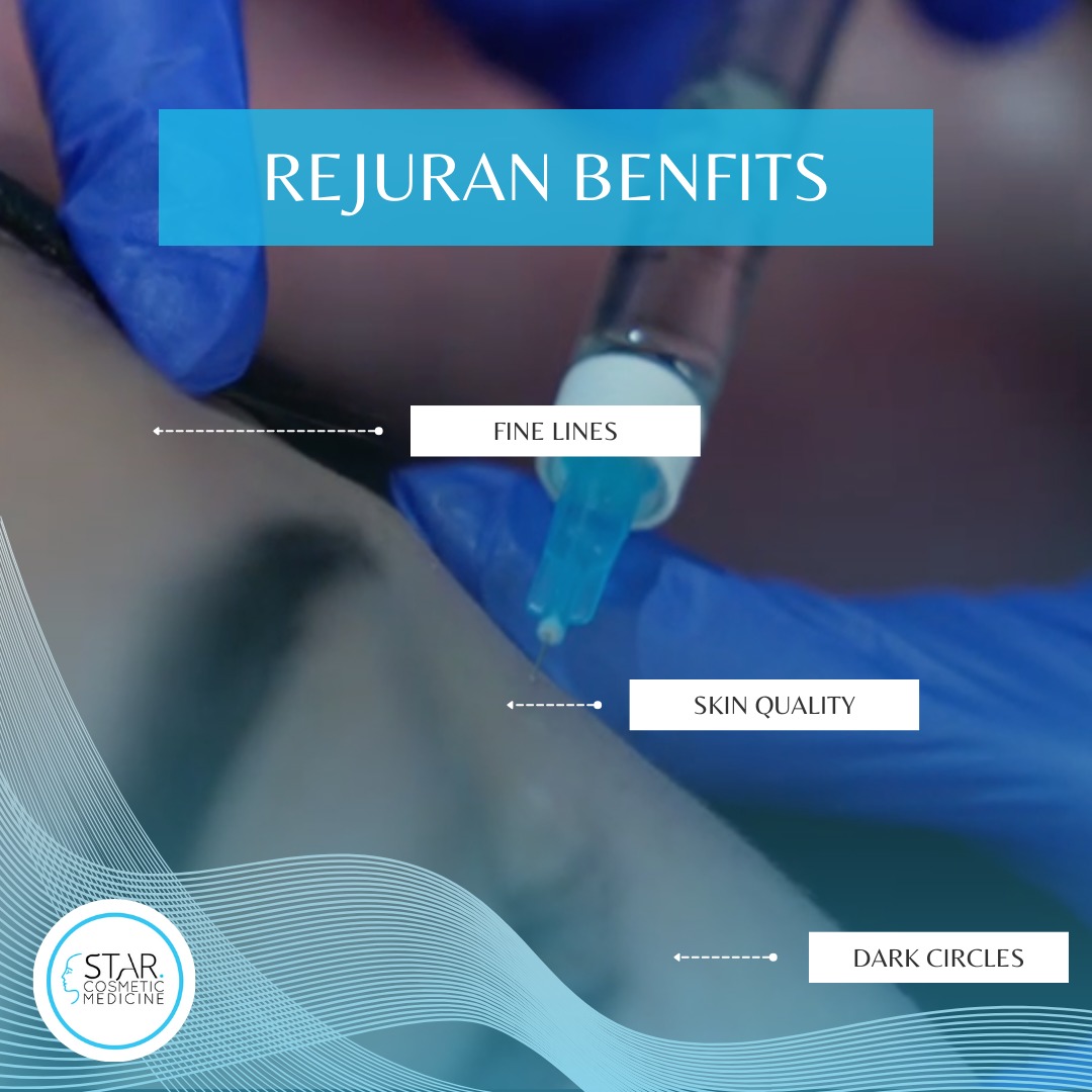 Star Cosmetic Medicine Facebook ad: Restore your skin with Rejuran