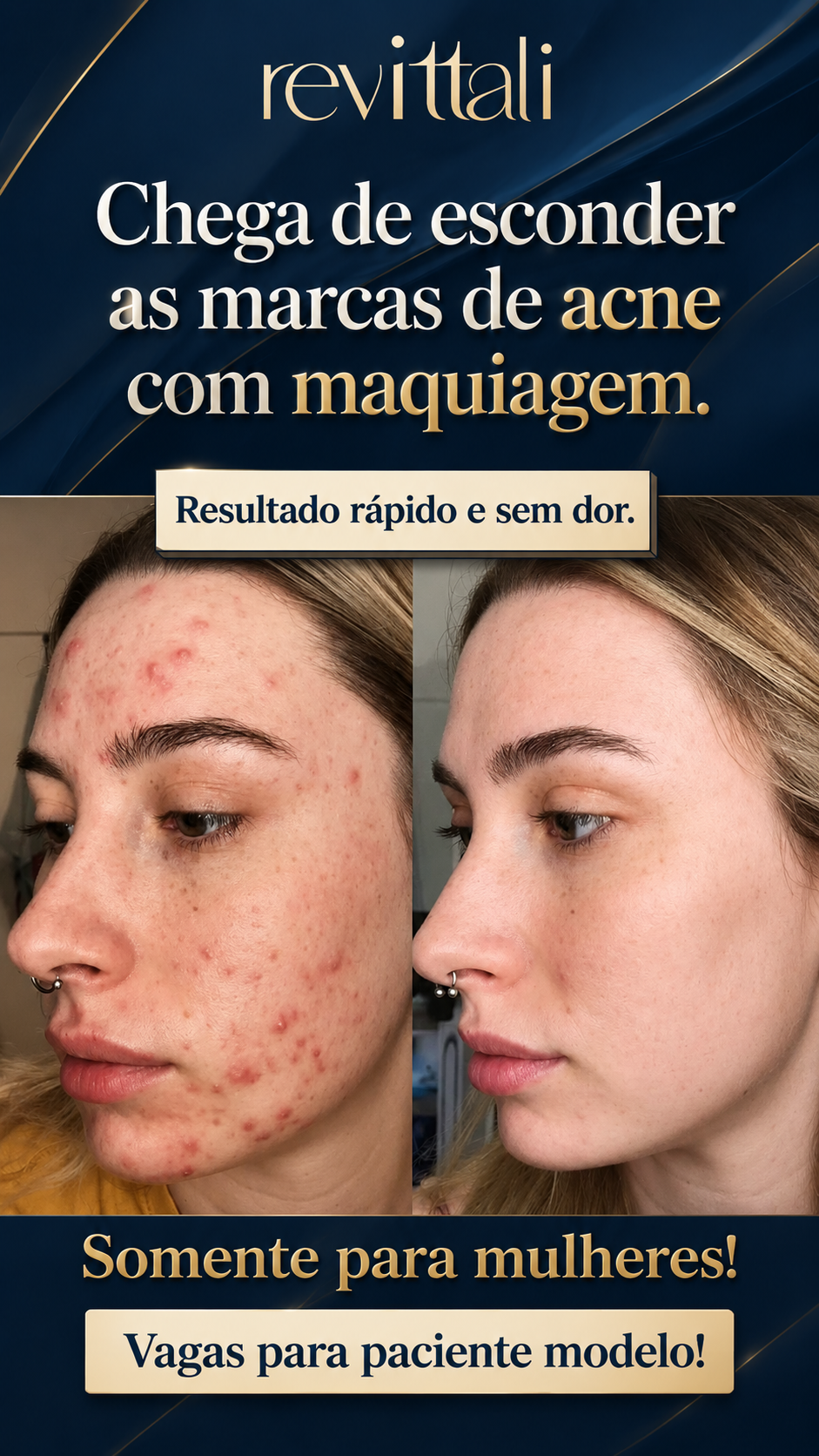 Revittali Facebook ad from May 16, 2026