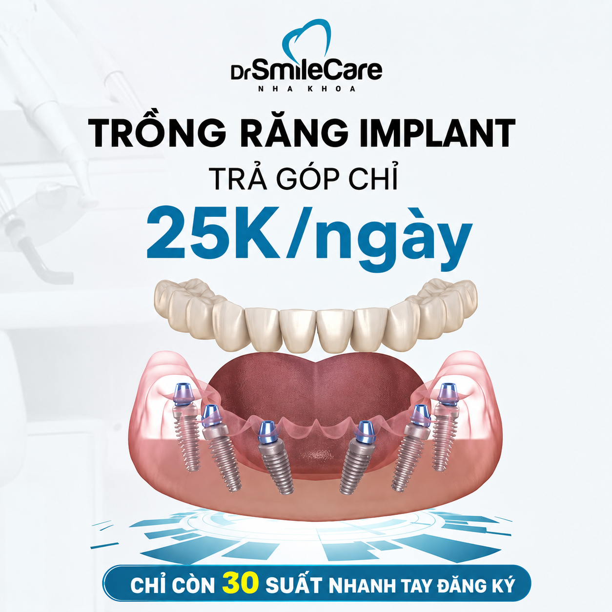 Dr.SMILECARE Gò Vấp - Trụ Implant chính hãng Facebook ad: Tư vấn ngay với bác sĩ