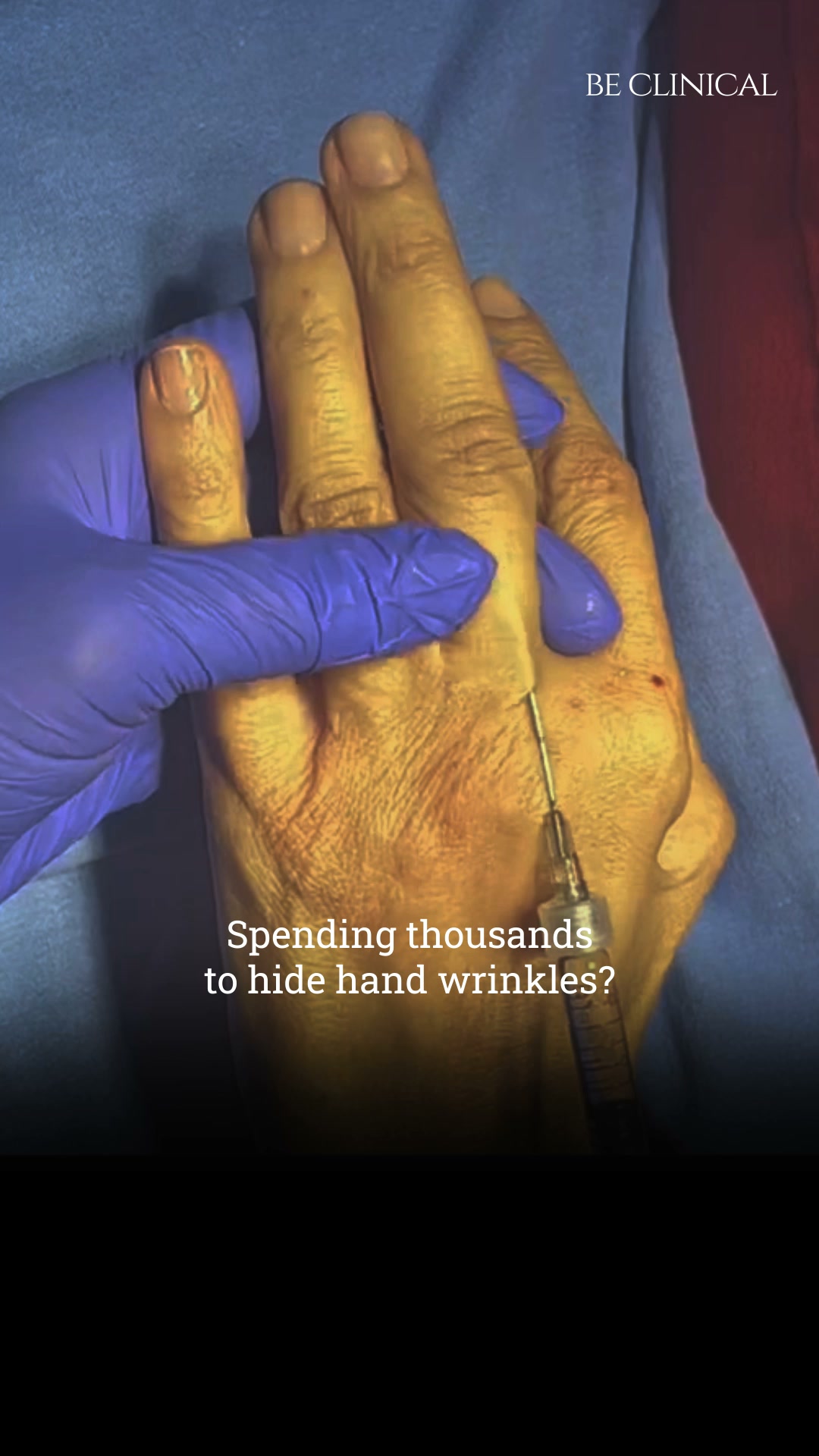 Be Clinical Facebook ad: Say Goodbye to Dry, Wrinkled Hands, Hello Youthful Softness!