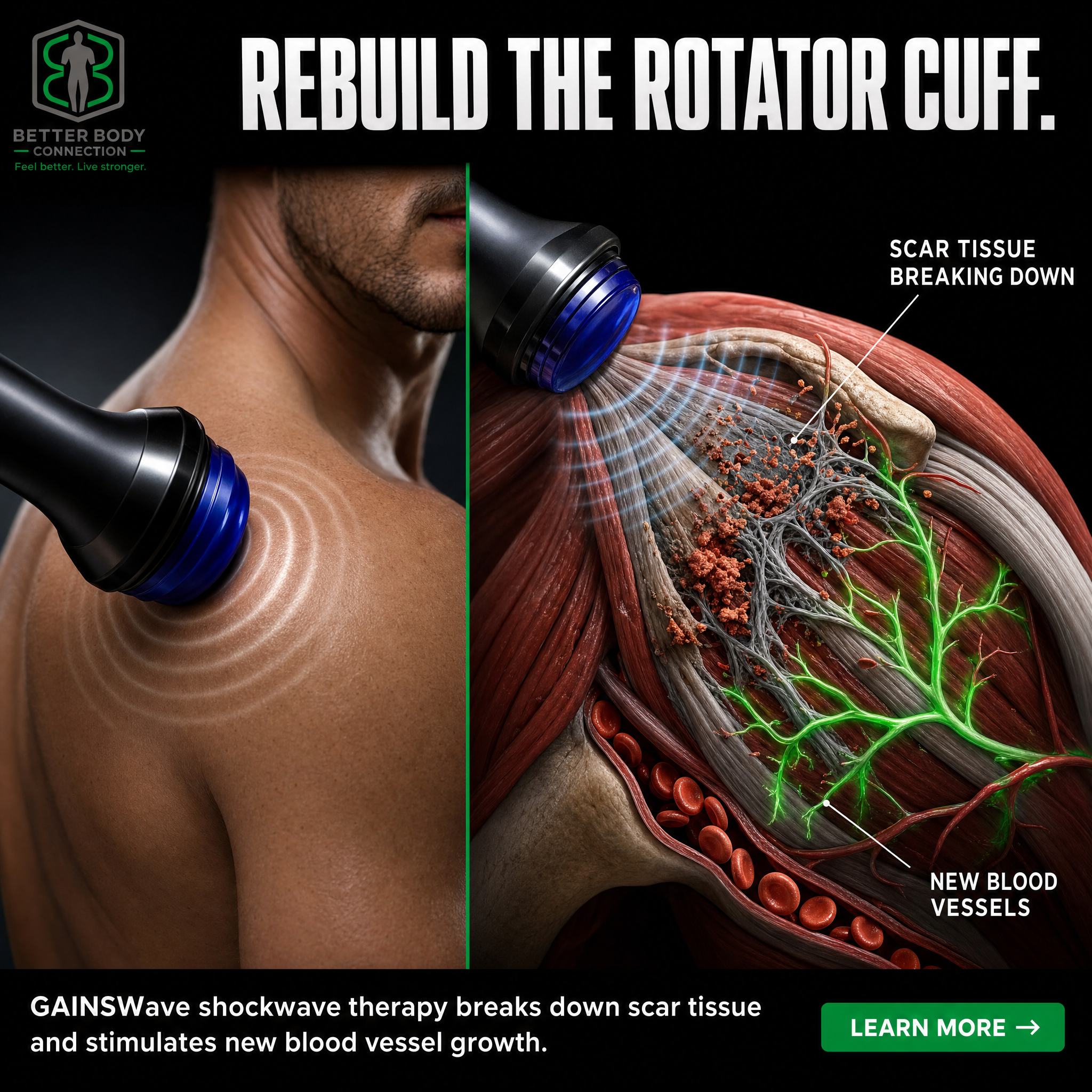Better Body Connection Facebook ad: Des Plaines We Got You!