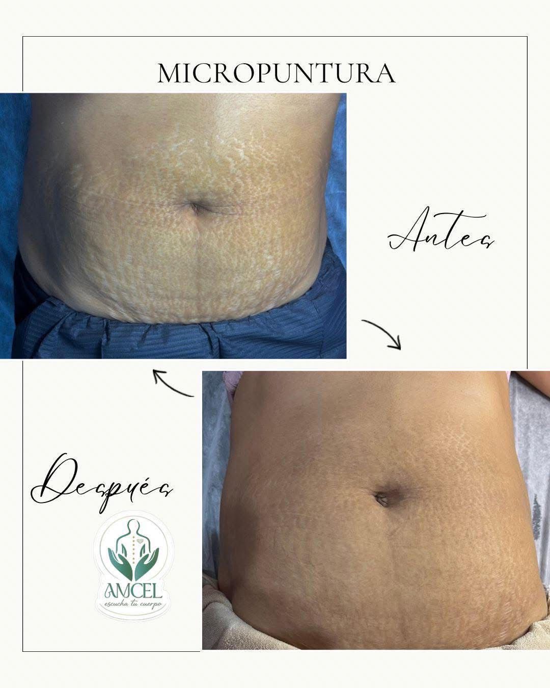 AMCEL Facebook ad: ¿Ya conoces 𝐀𝐌𝐂𝐄𝐋 SPA?
