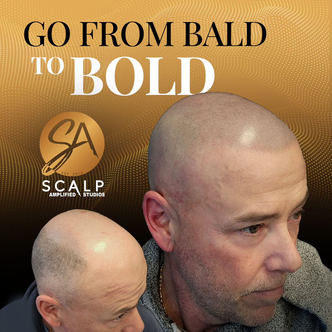 Scalp Amplified Studio. SMP studio Facebook ad: Ontario, Stop Hair Loss Without Surgery