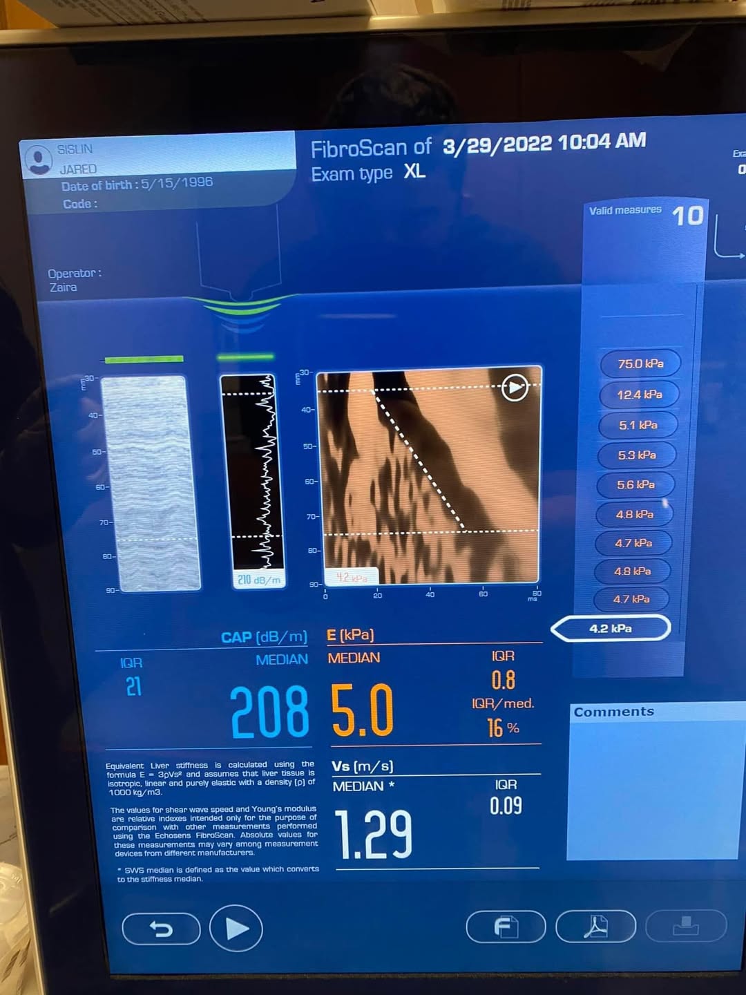 David Andrews Facebook ad: Feeling Bloated? It Might Be Your Liver.