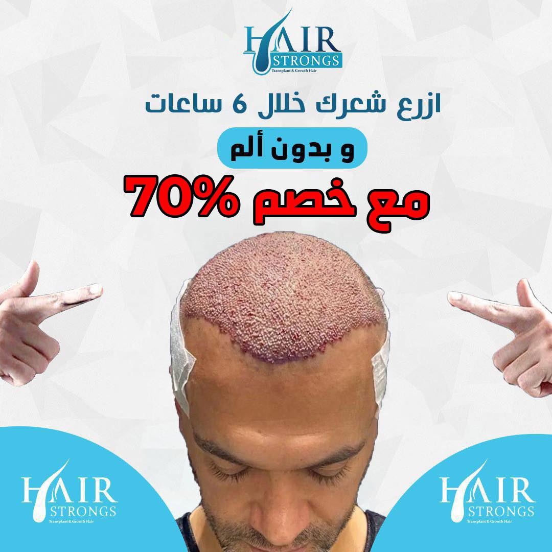 Hair Stronges Facebook ad: جديد جديد العرض الاقوى لموسم الشتاء