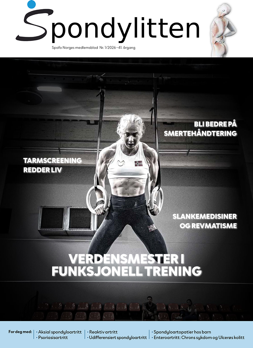 Spafo Norge - Spondyloartrittforbundet Norge Facebook ad
