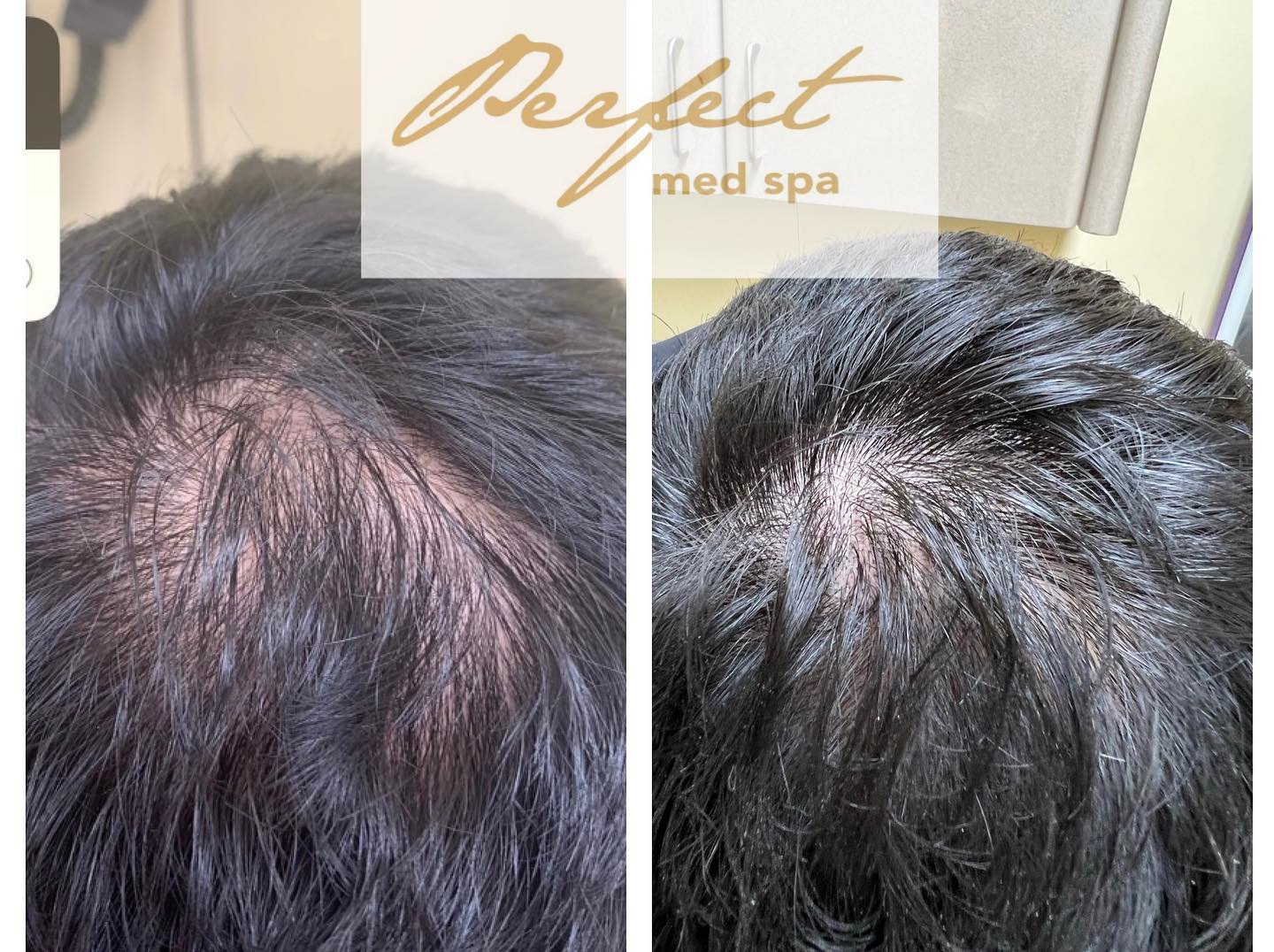 Perfect MedSpa Facebook ad
