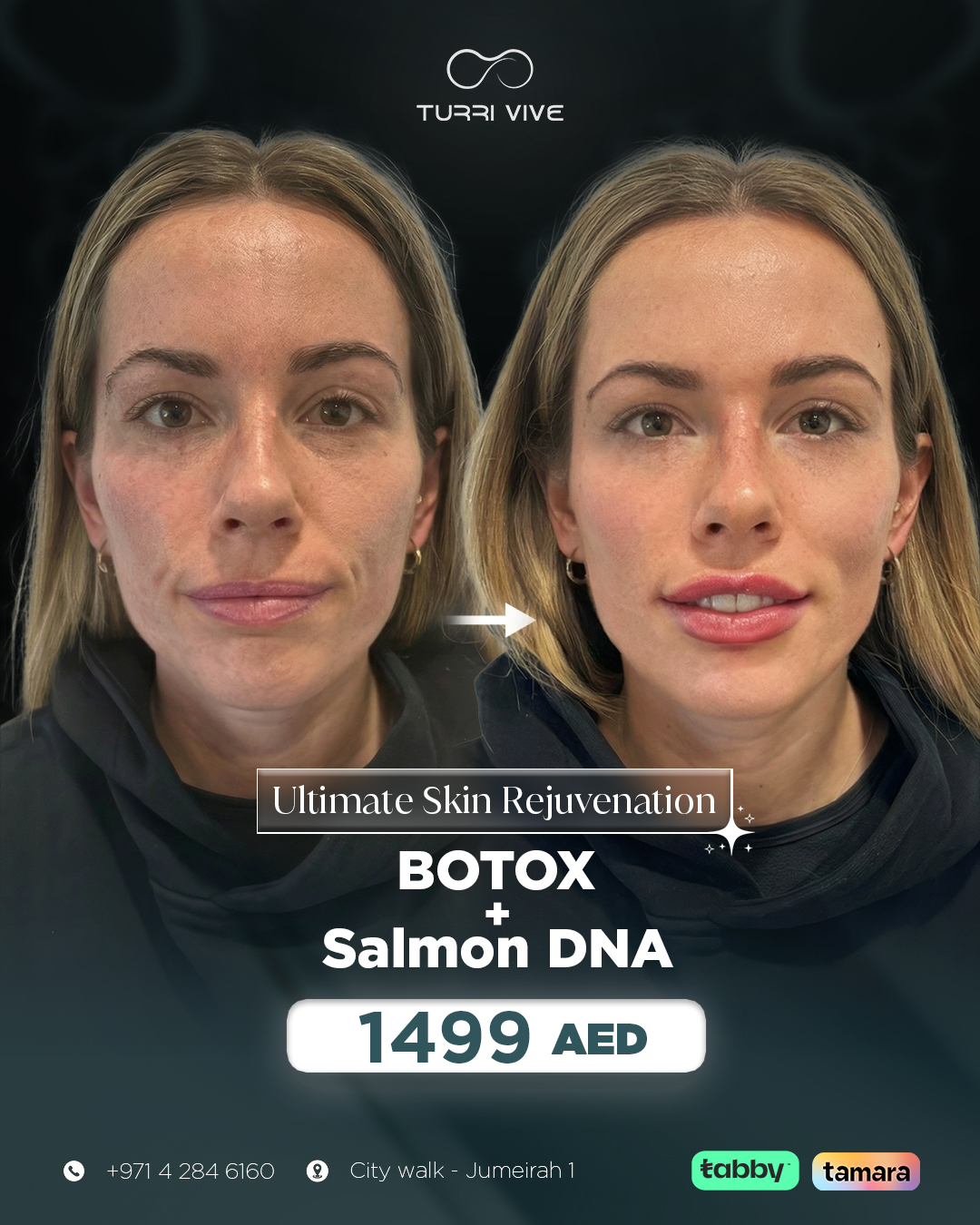Yas & Lejou Medical - TURRI VIVE Facebook ad: Reveal smoother, firmer, radiant skin with Botox +…