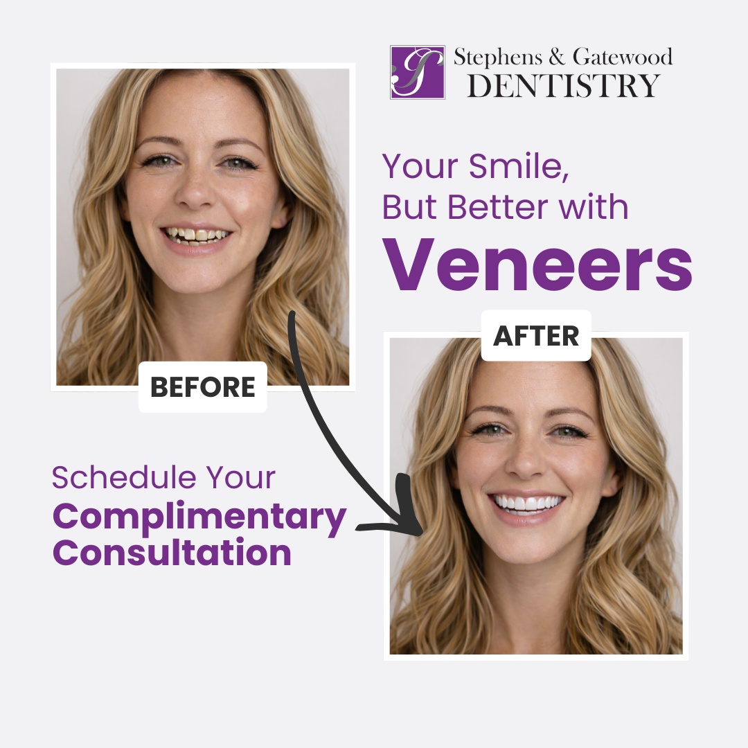 Stephens & Gatewood Dentistry - Cypresswood Facebook ad: Dental Veneers - FREE Consultation