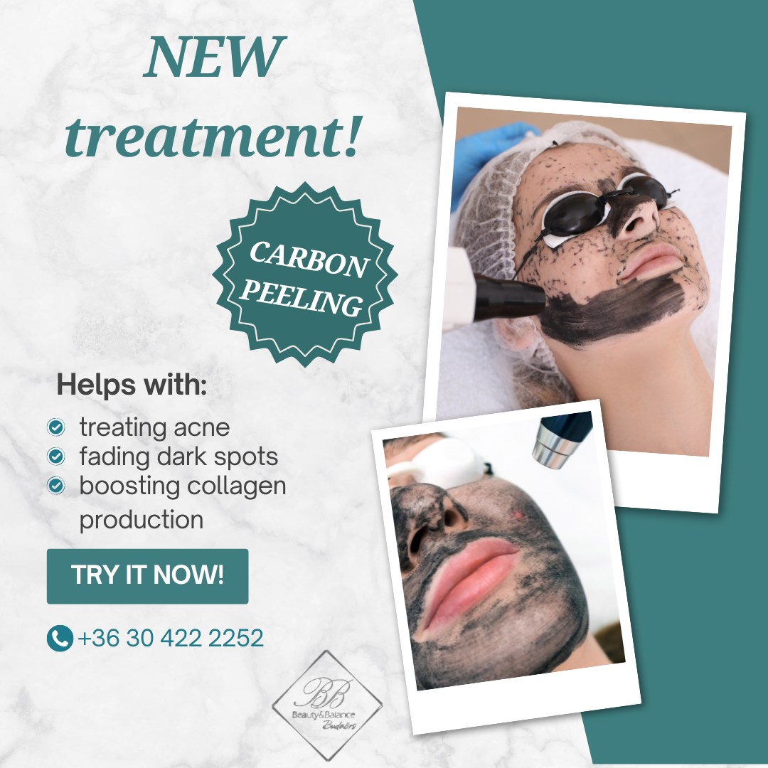Beauty & Balance Budaörs Facebook ad: Skin rejuvenation with Carbon Peeling