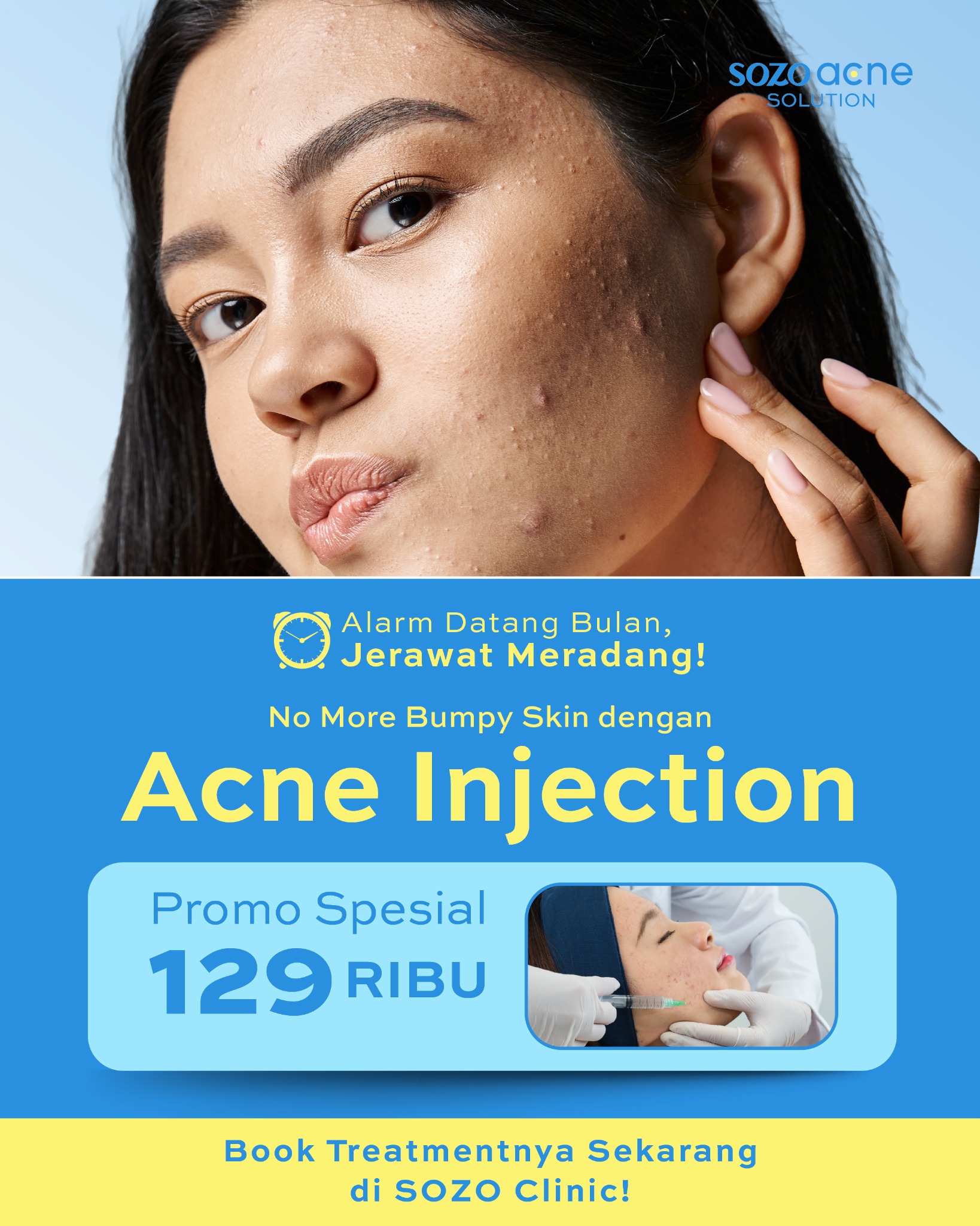 Sozo Skin Clinic Facebook ad