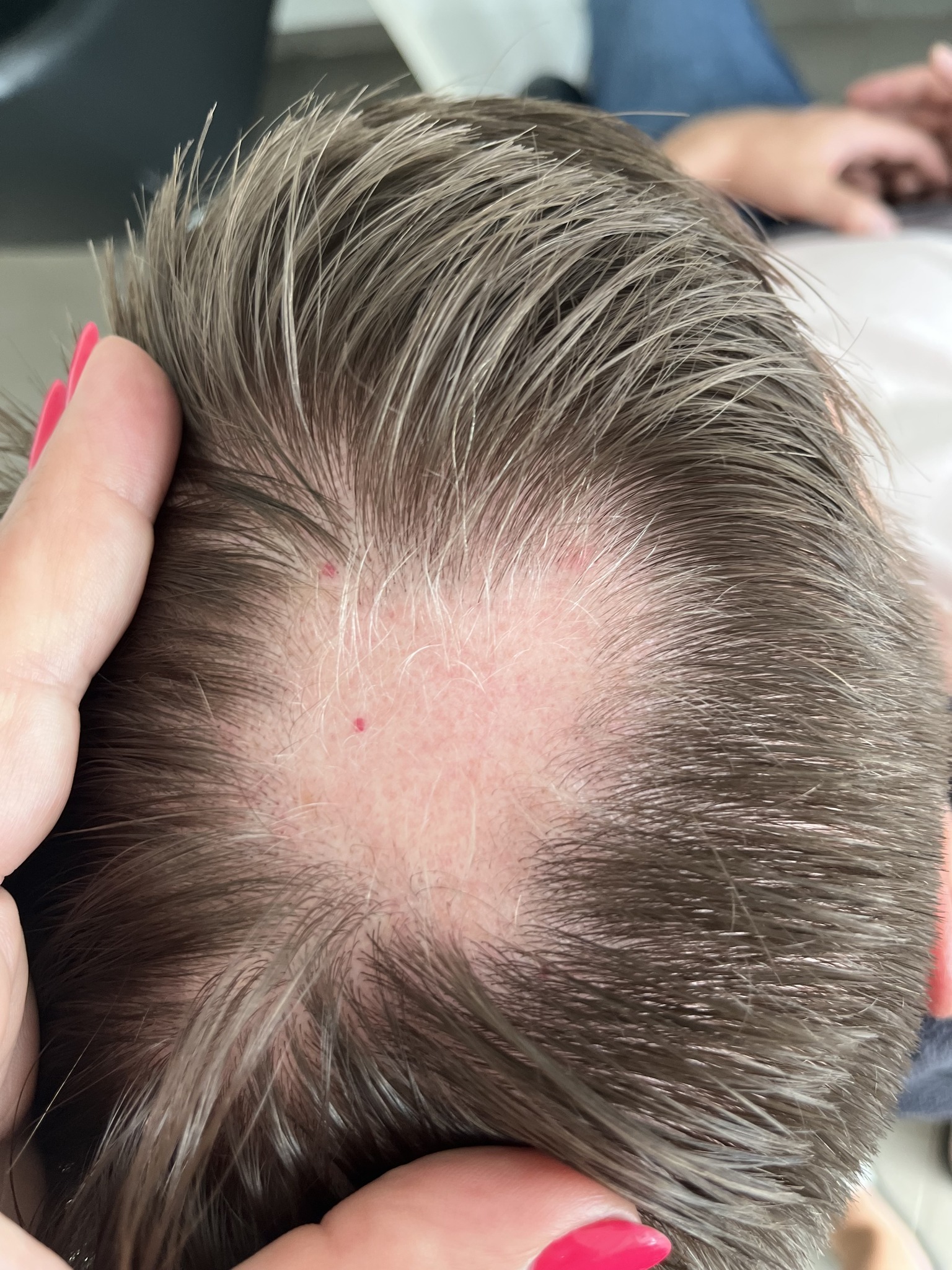 Oxygeni Hair & Skin  Hajgyógyász és Bőrterápia Szalon Mosonmagyaróvár Facebook ad