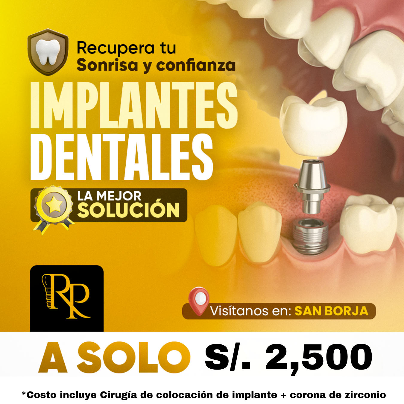 Centro Odontológico Renzo Perez Facebook ad from May 4, 2026