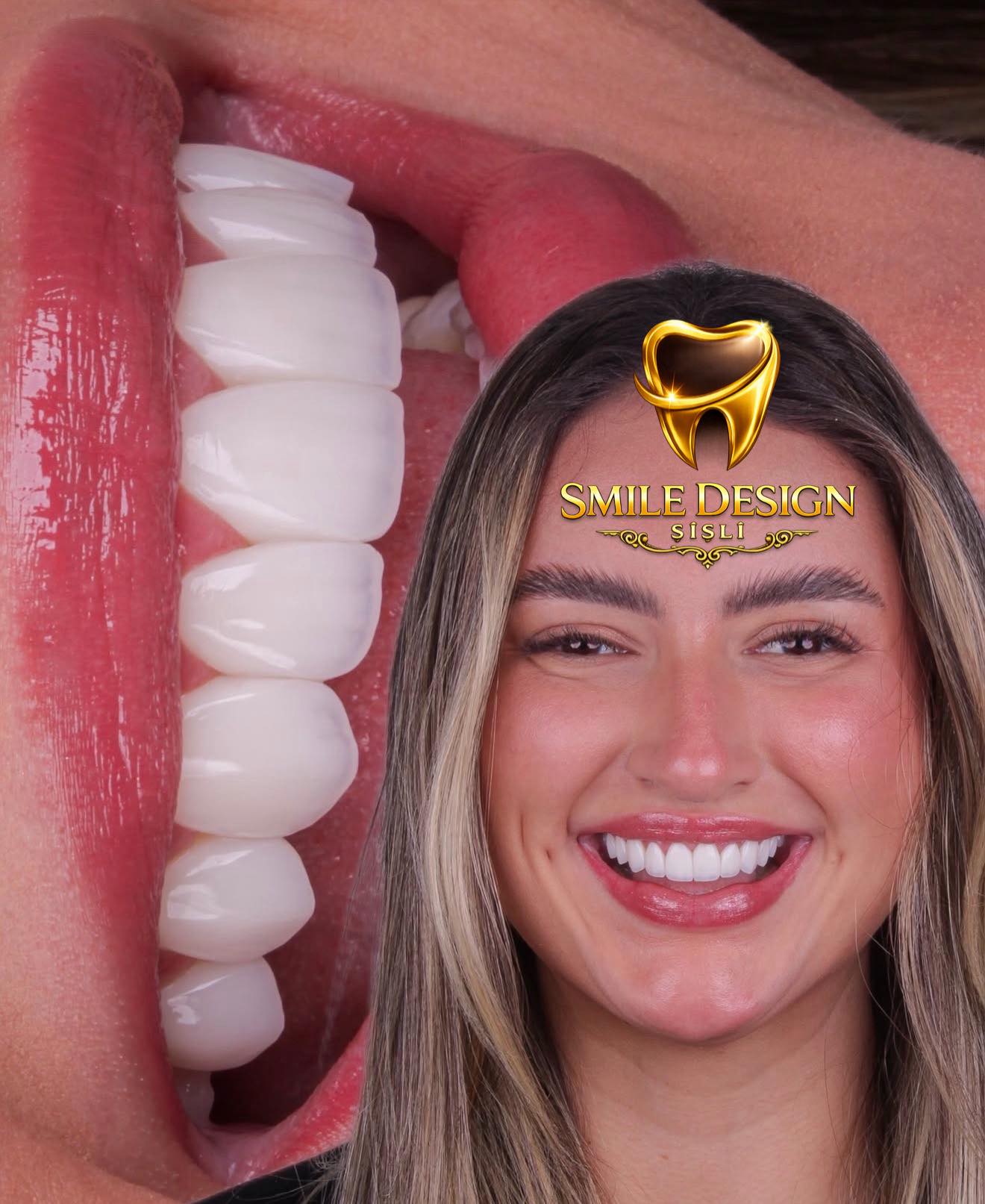 Smile Design Şişli  Facebook ad