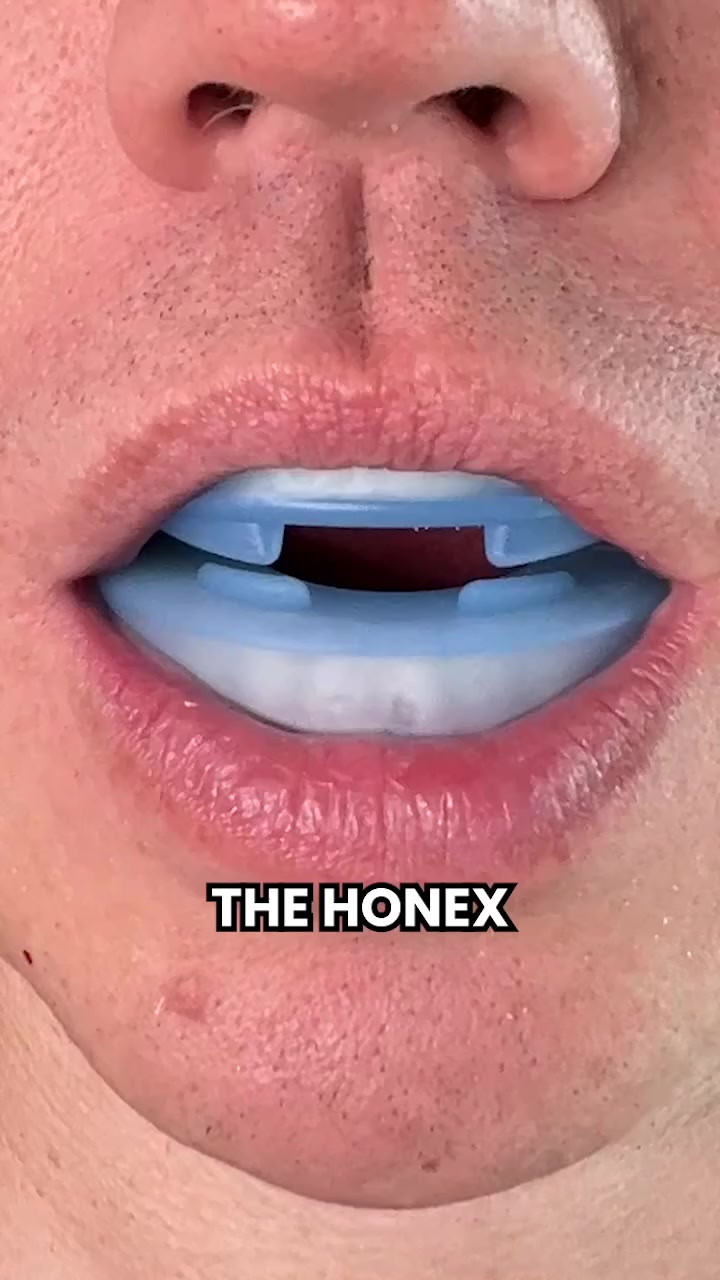 Honex Facebook ad: Final Sale Ends Today!