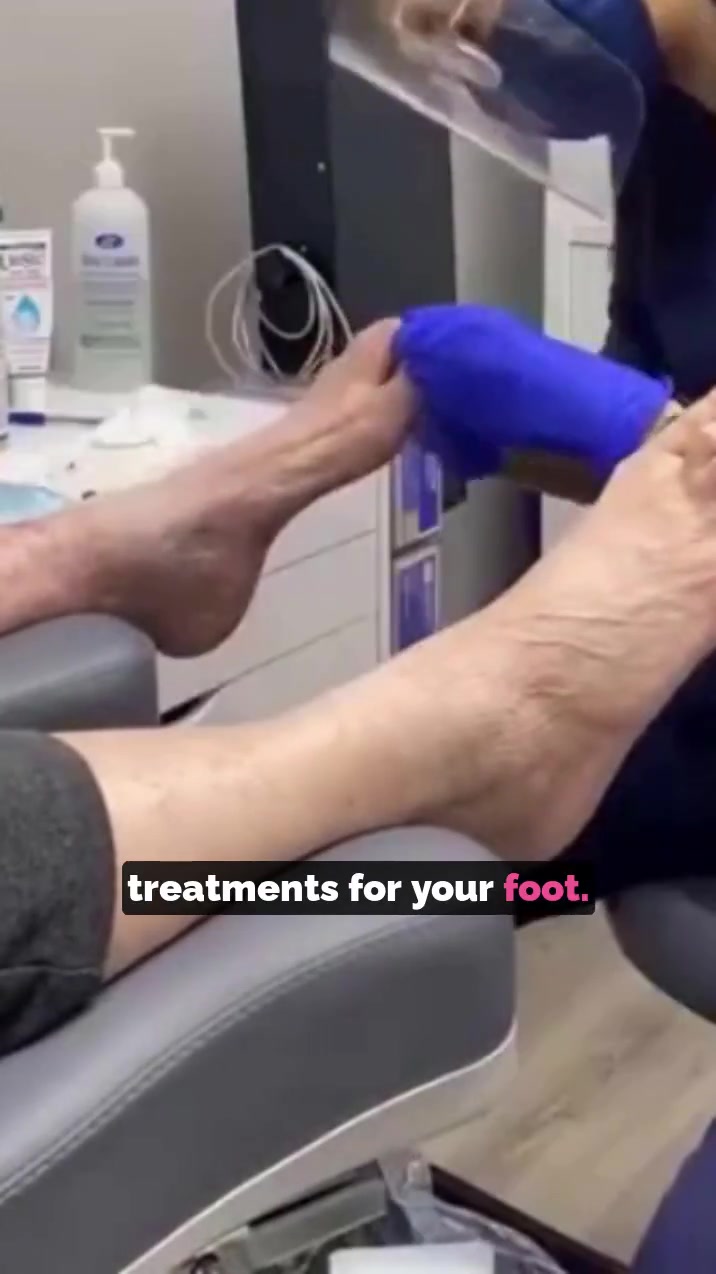 Wilson Health Services Facebook ad: Orthotics and Foot Care Services. Reserve your appointment.