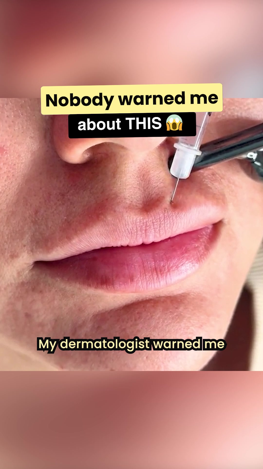Phyto-C Skin Care Facebook ad: Dermatologist: Skip The $2K Filler For Smoker's Lines-Use…