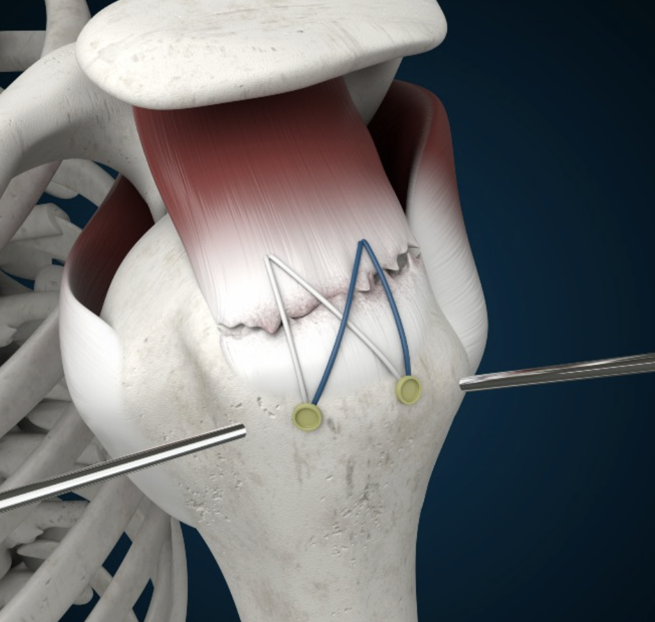 Dr. Elizabeth Monroe, MD Facebook ad: End That Chronic Pain in 3 Weeks