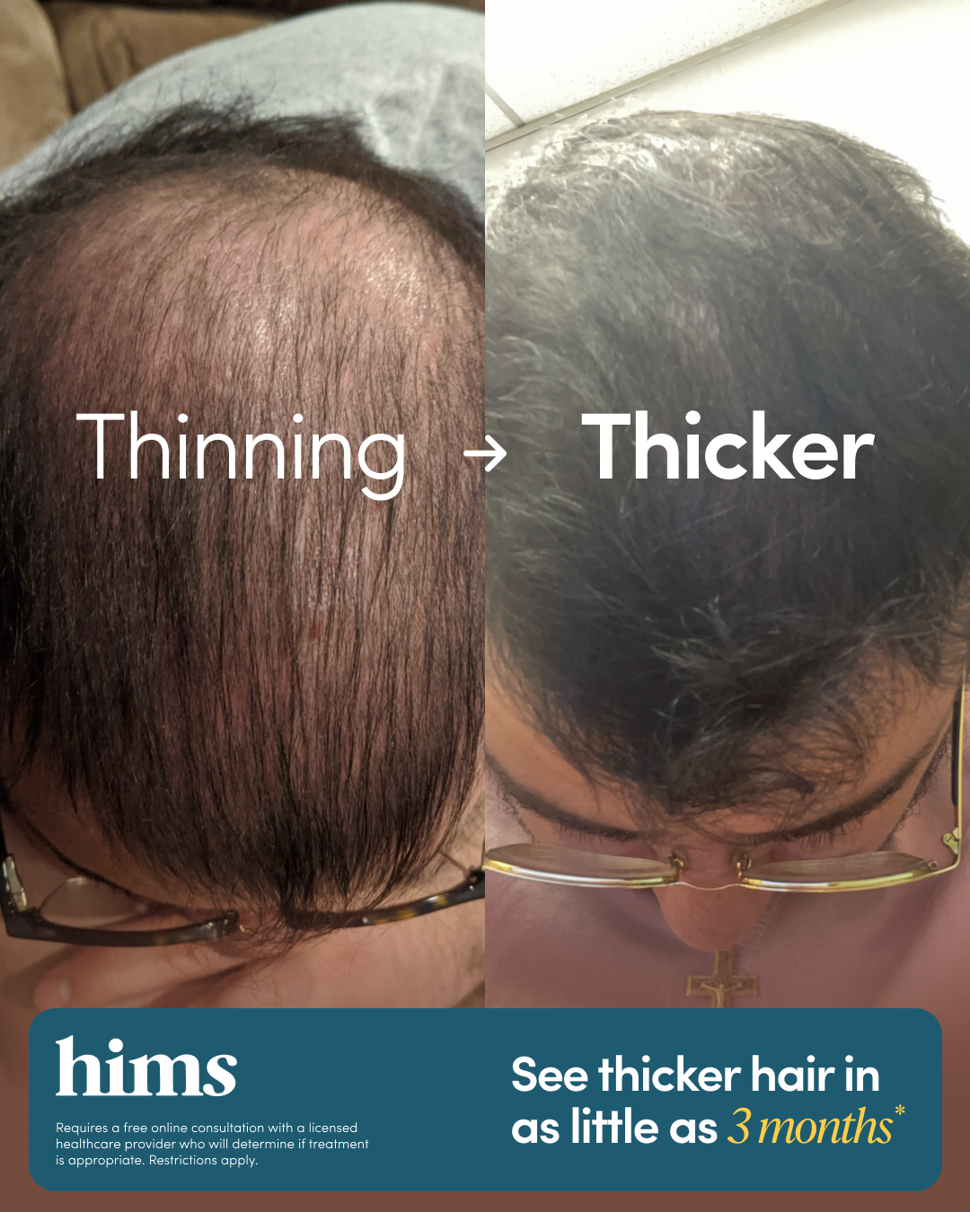 hims Facebook ad