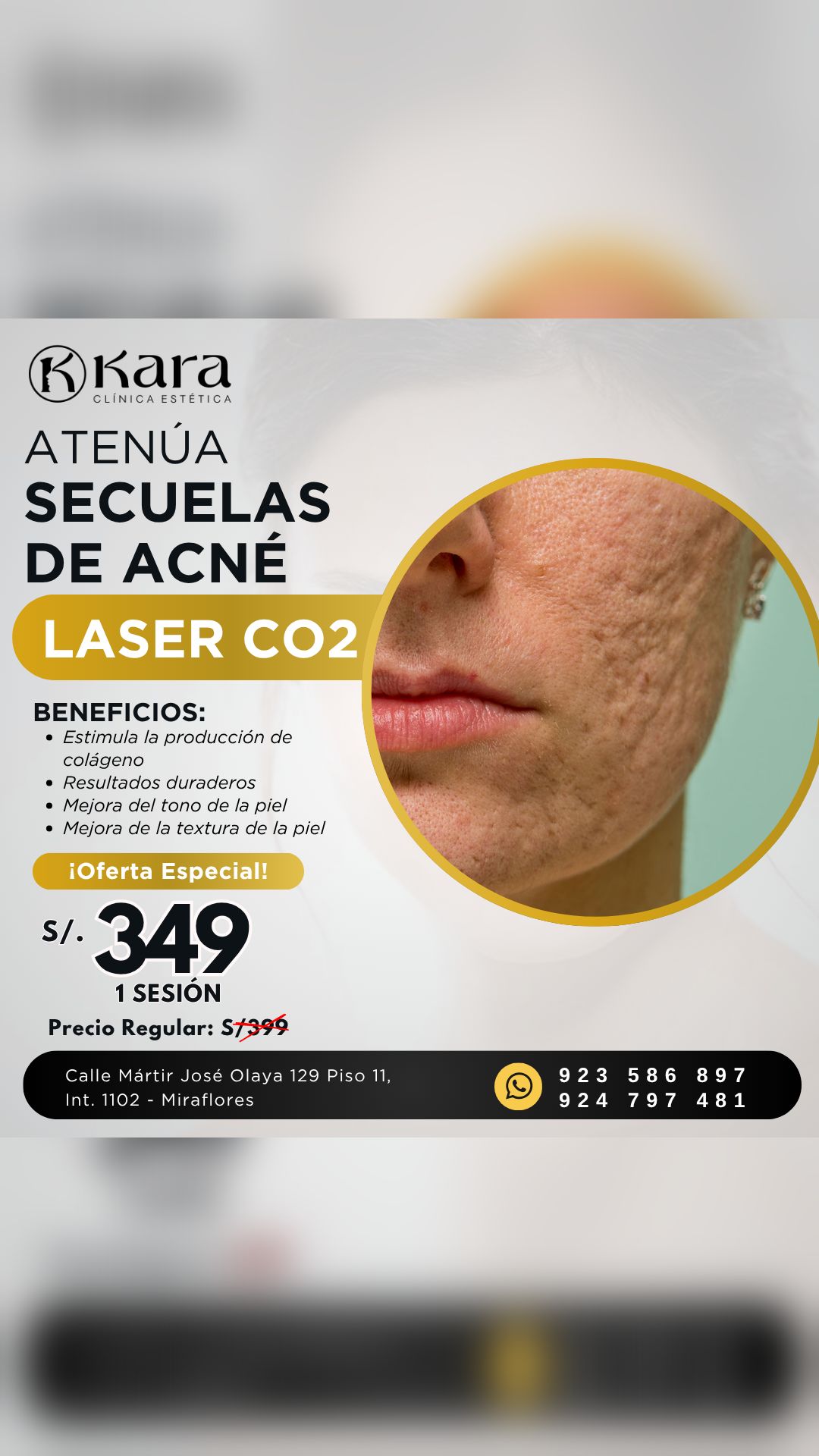 Kara - Clínica estética láser Facebook ad from May 21, 2026