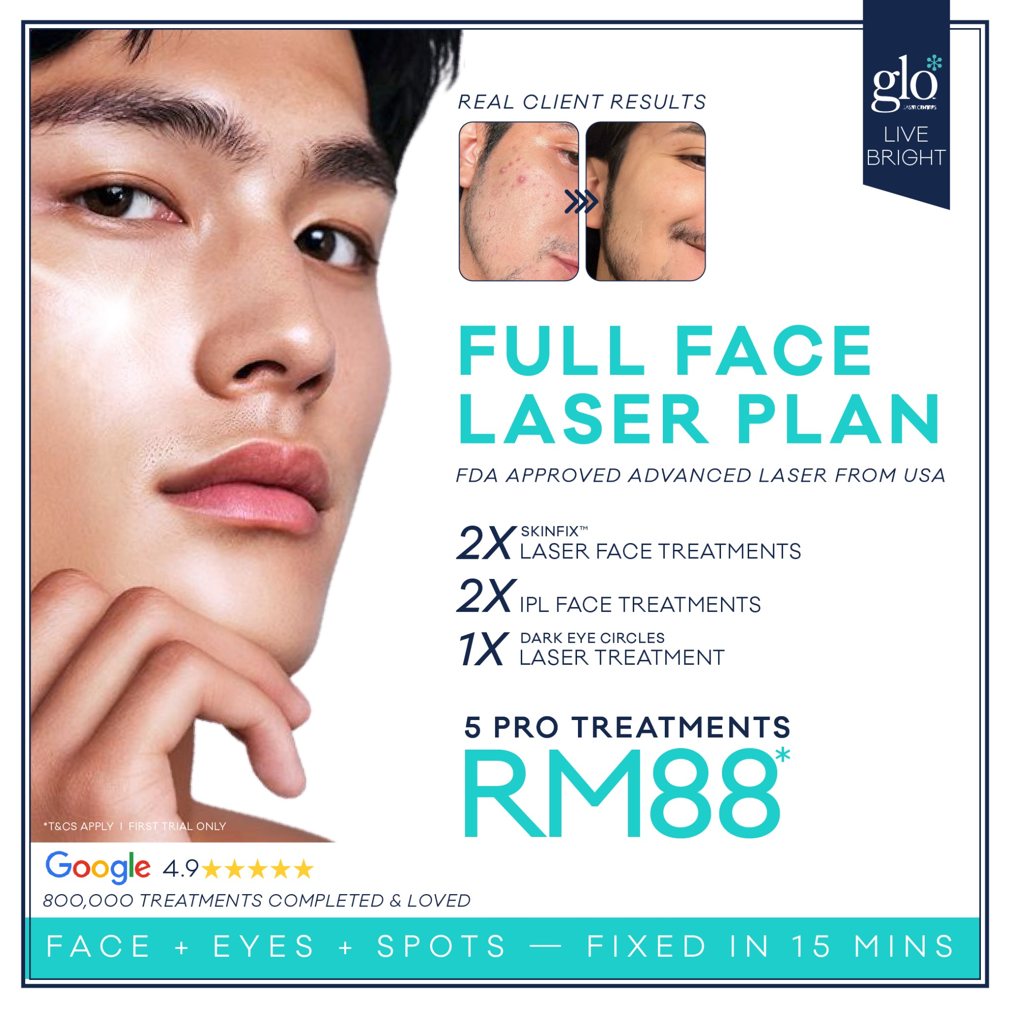 Glo Laser Centres Facebook ad: Look fresh. Stay sharp.