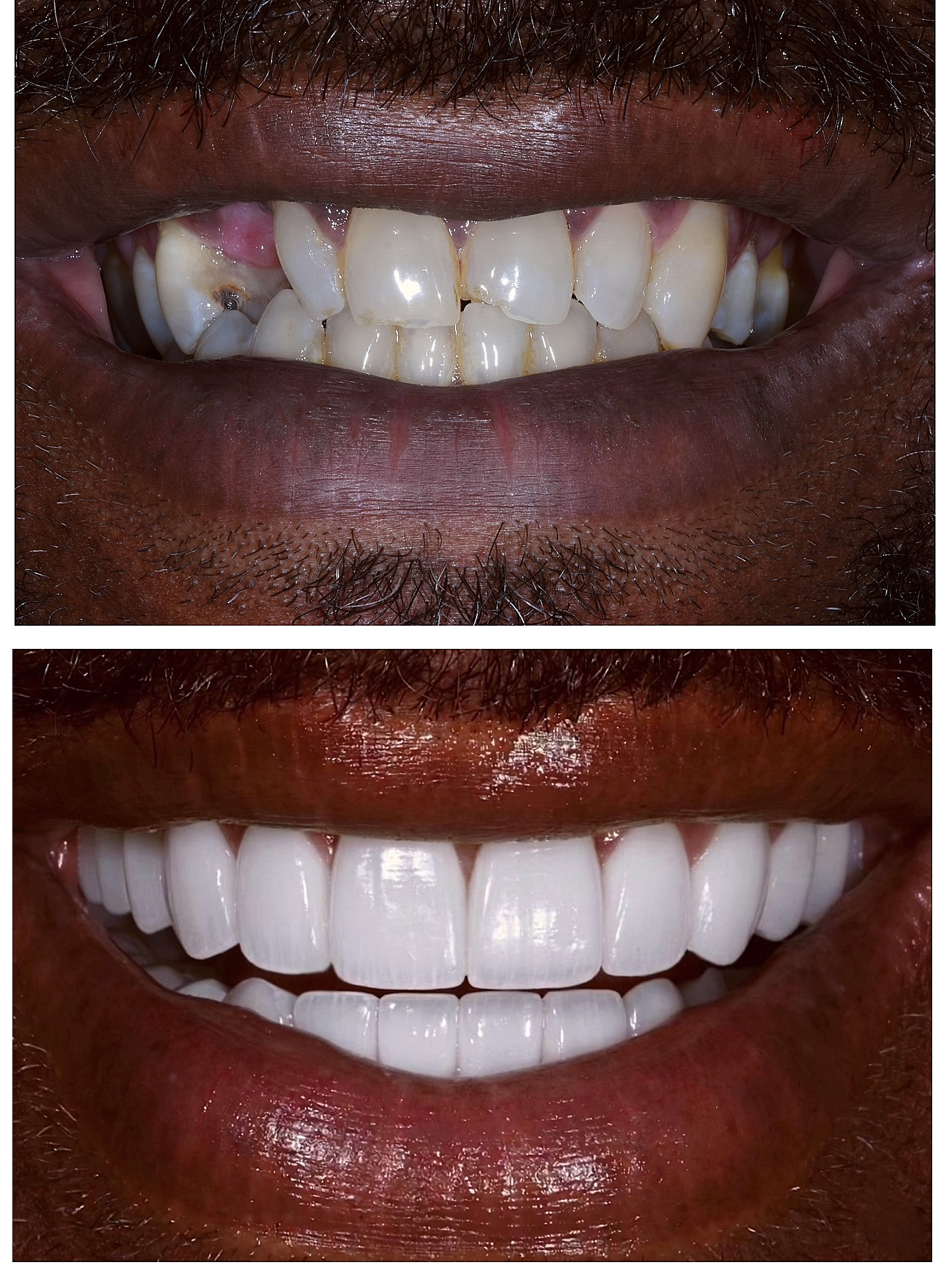 L.A. Smile Specialists Facebook ad: A Fresh start with the help of full…