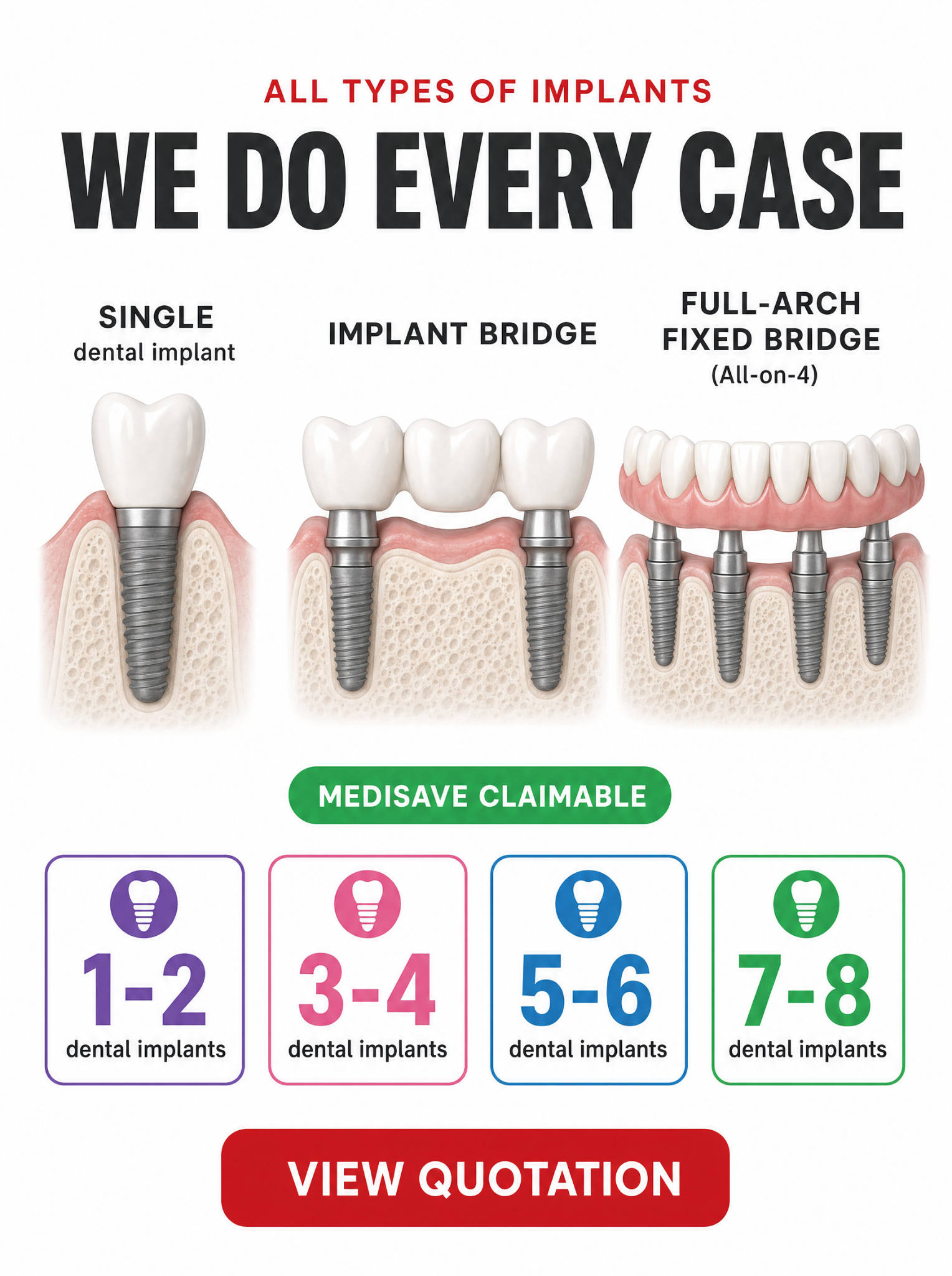 NoFrills Dental Facebook ad: Medisave Claimable Dental Implants