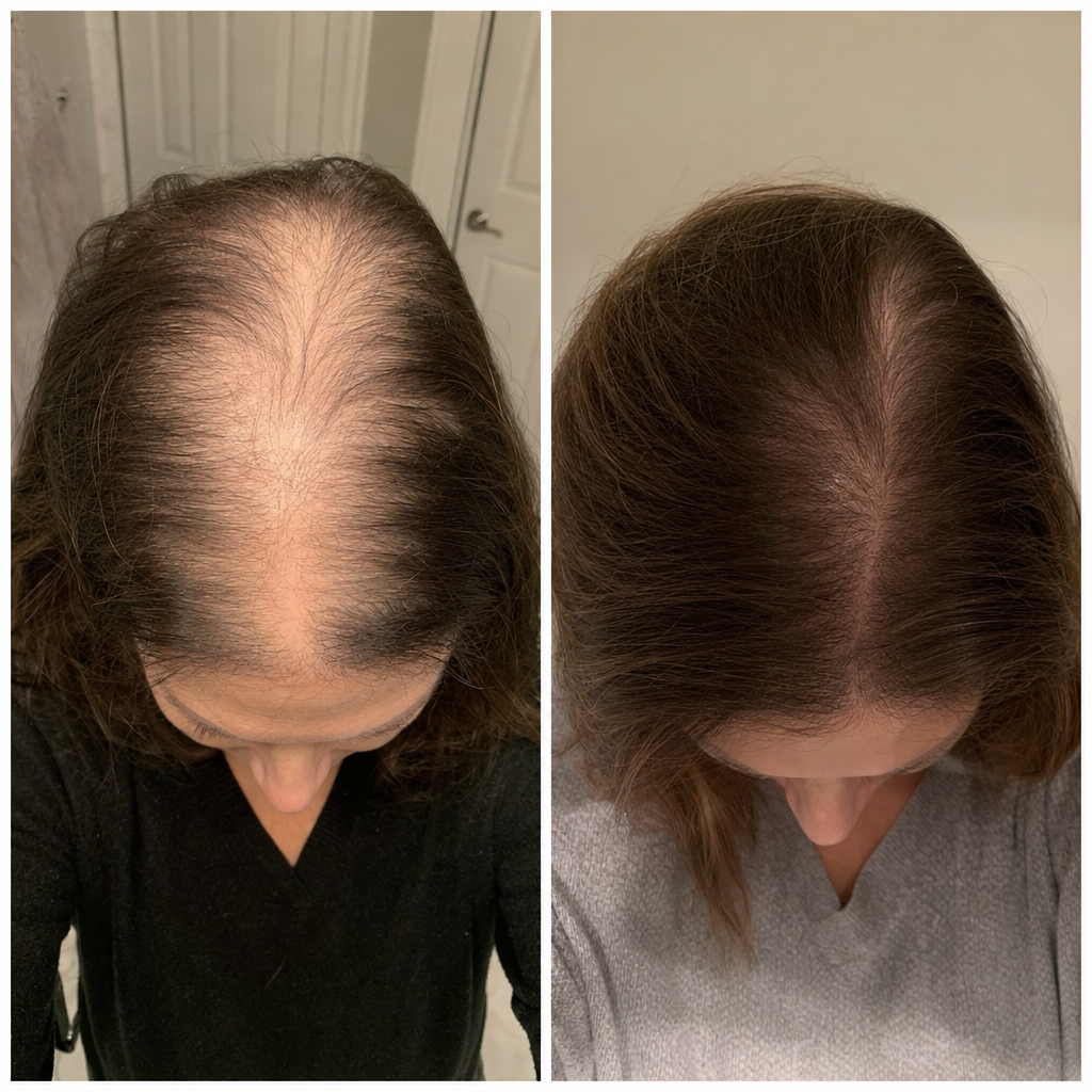 Elizabeth white Facebook ad: Menopause: How did they get their hair back?