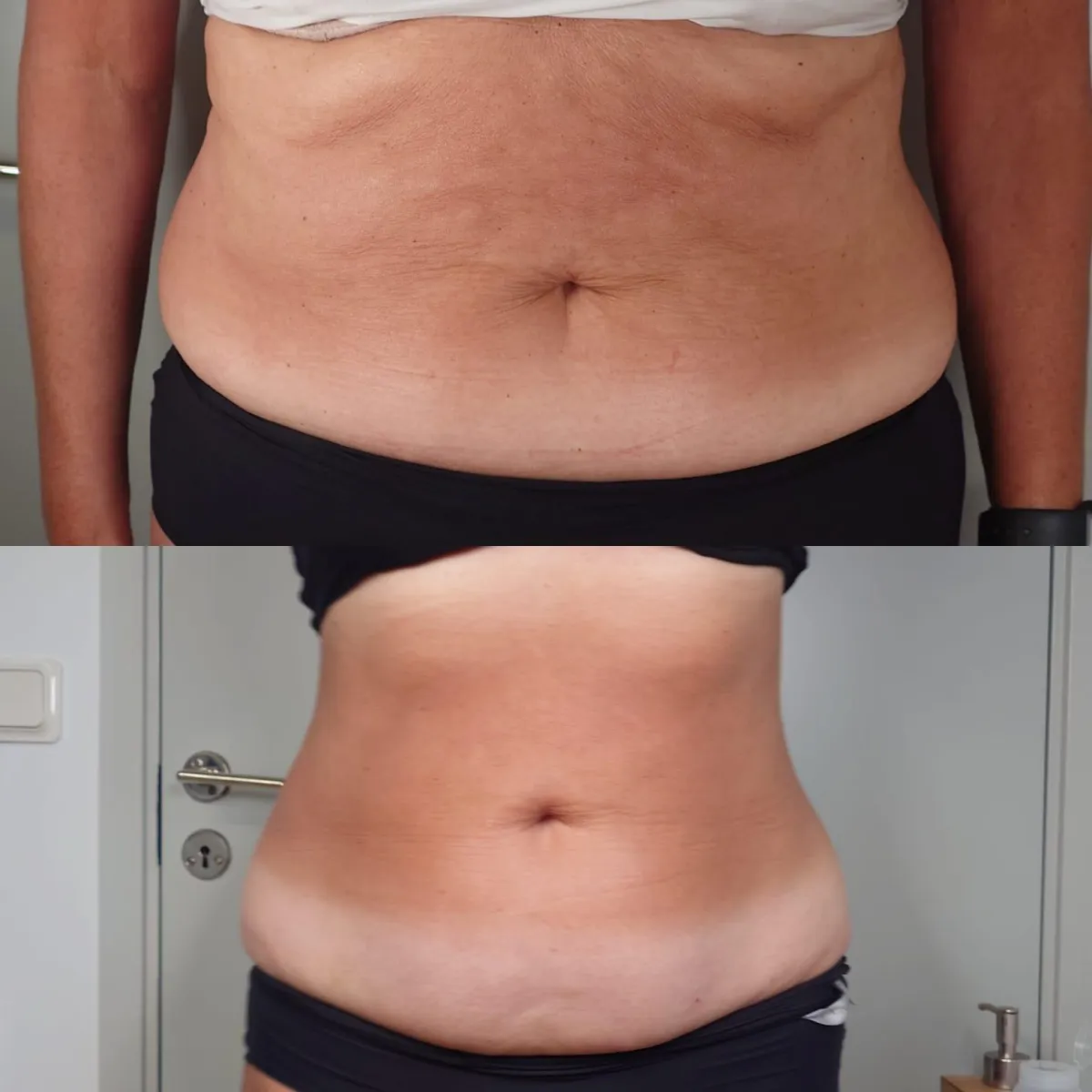 Regina's Beauty and Laser Clinic Facebook ad: Premium body treatment 3 different technologies, 60% off