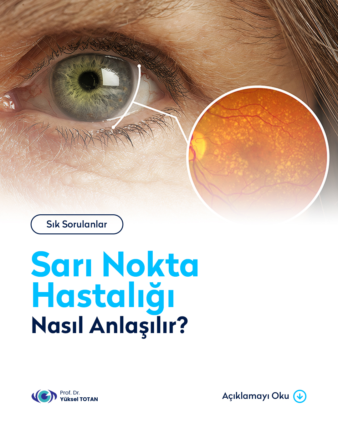 Prof Dr Yüksel Totan, Göz Hastalıkları ve Retina Cerrahisi Facebook ad