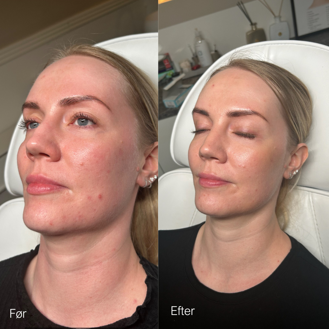 Klinik Uniik Facebook ad