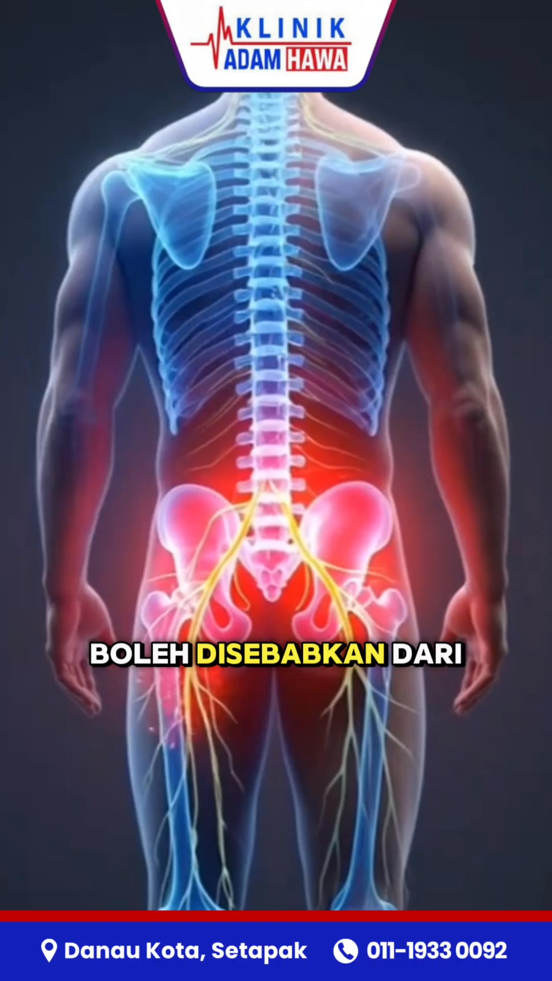 Klinik Adam Hawa Danau Kota Facebook ad: SAKIT PINGGANG SAMPAI TARIK KE BETIS? ITU SCIATICA!