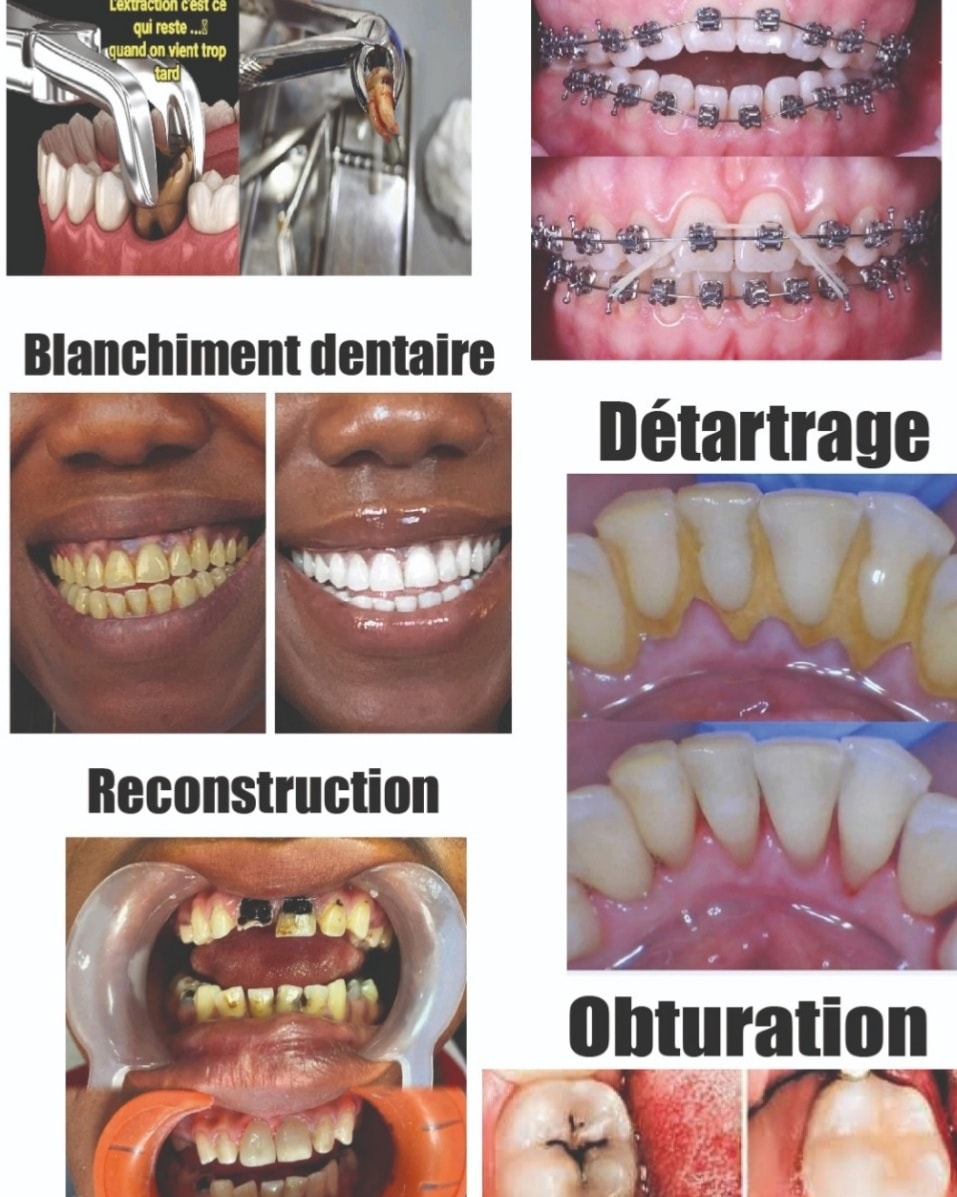 Cabinet Dentaire du centre médical Sainte Marie de bonaberi Facebook ad: TOP 4 des maladies dentaires silencieuses que tu…