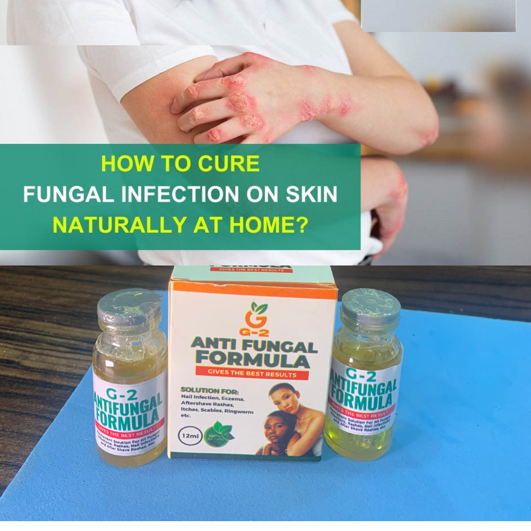 Fungal Natural Remedy Facebook ad