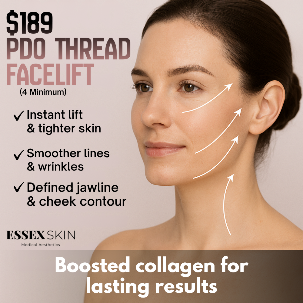 Essex Skin Chicago Facebook ad: $189 PDO Threads in Chicago (4 Thread Minimum)