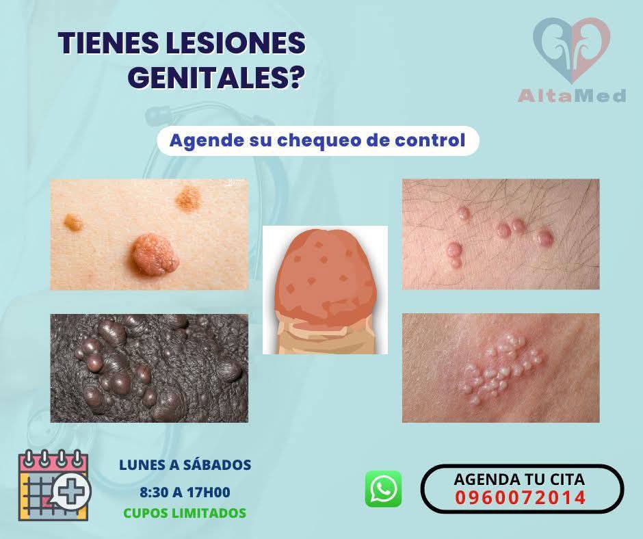Dr. Luis Cruz Bonilla Facebook ad: PROMO UROLOGÍA EN MANTA