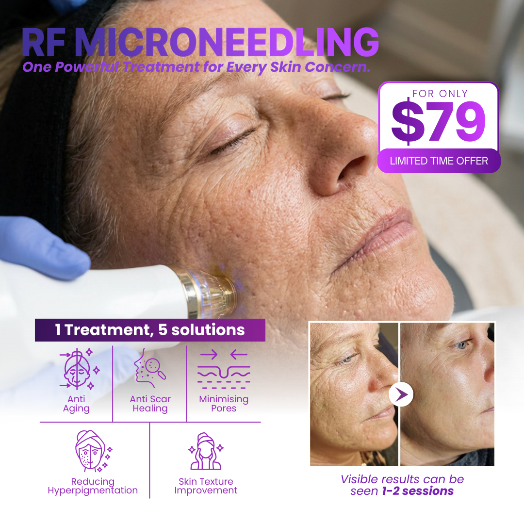 Love My Skin Treatments Facebook ad