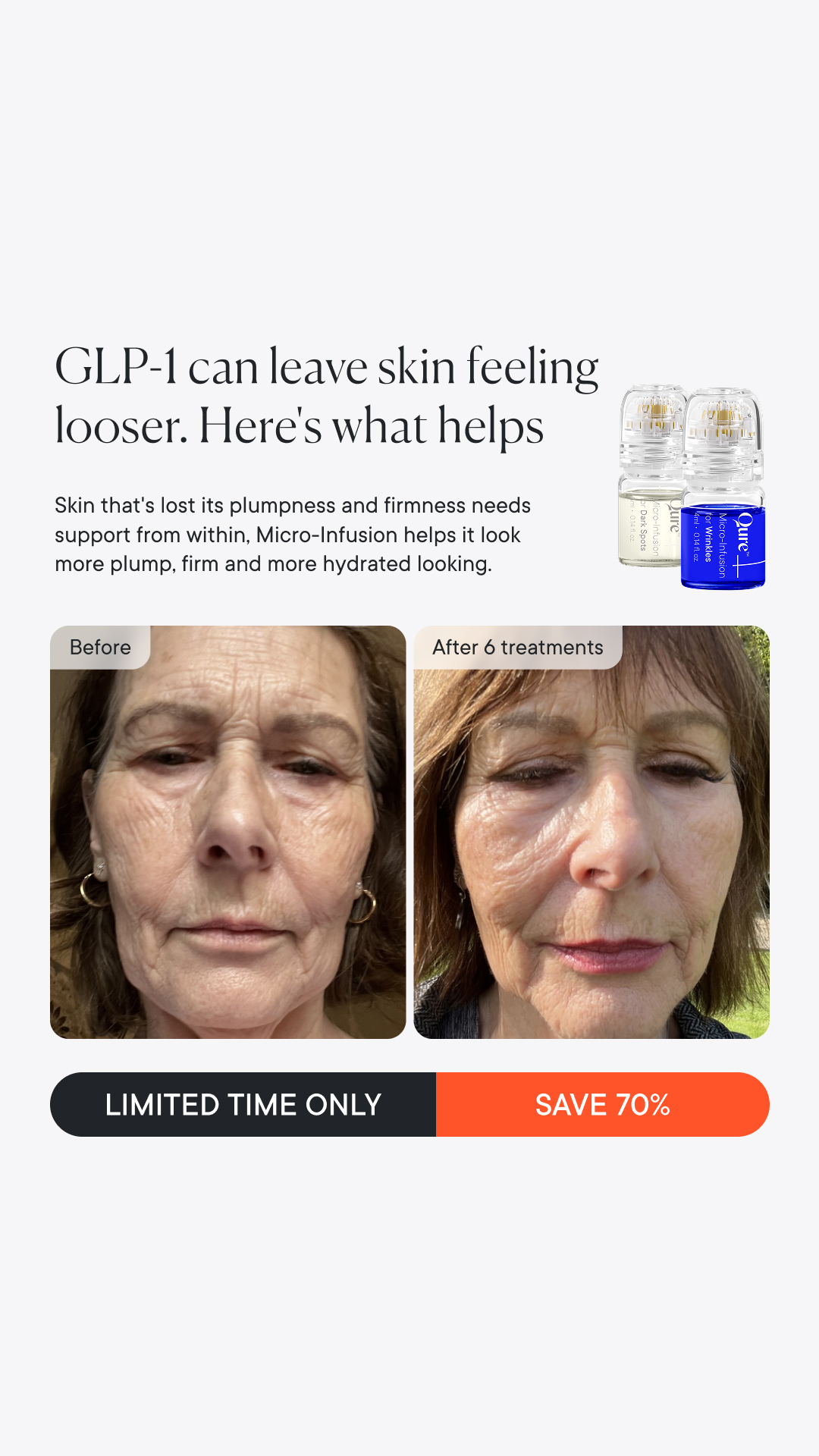 Qure Skincare Facebook ad