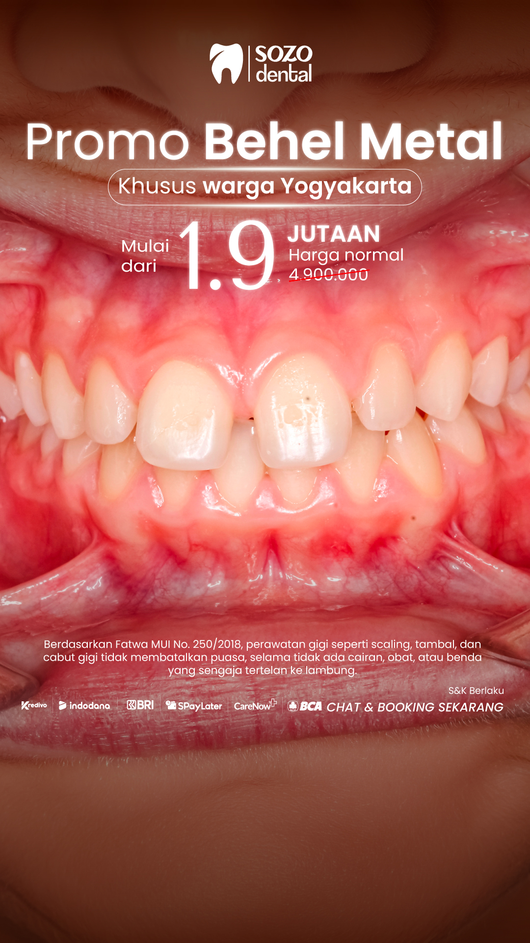 Sozo Dental Clinic Facebook ad