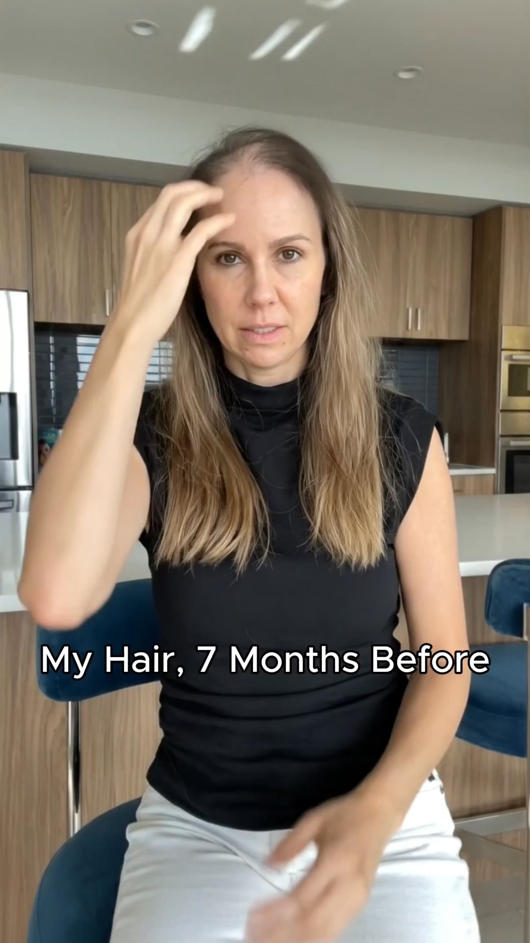 Consumer Report Daily Facebook ad: Real Hair Regrowth, Without Drugs